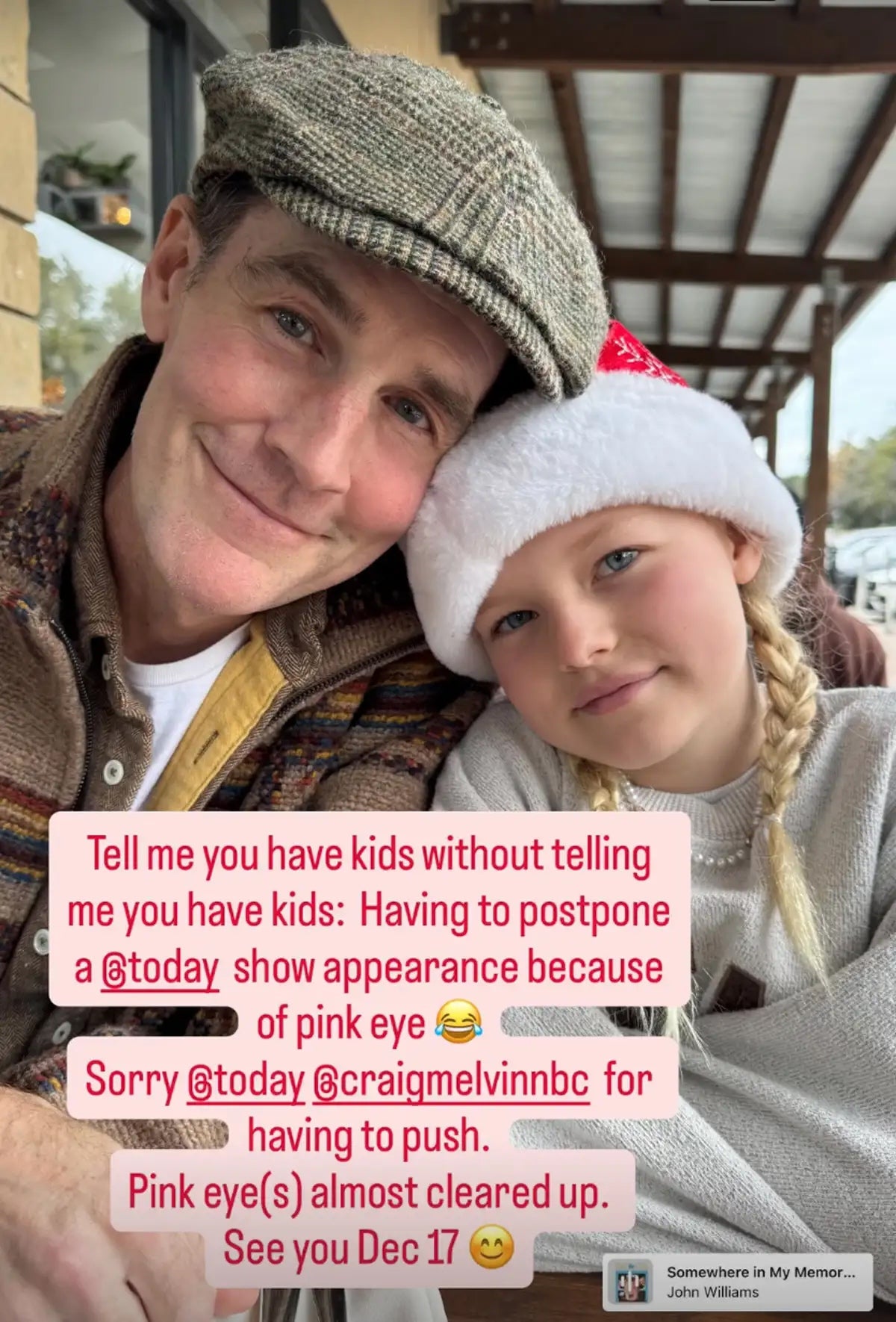 James Van Der Beek revealed the reason for his absence was pink eye