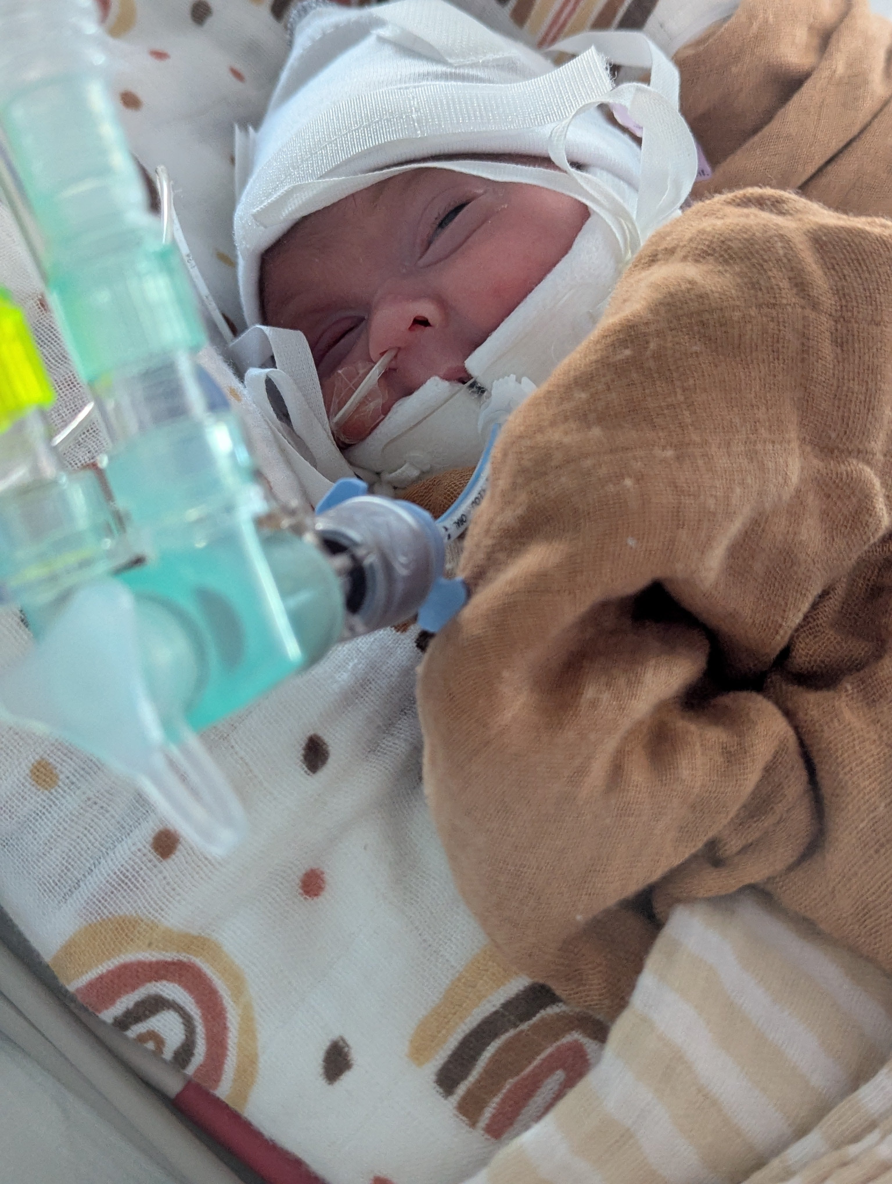 Anita Ibrahim-Goddard and Paul Goddard's son Adam in hospital after his premature birth