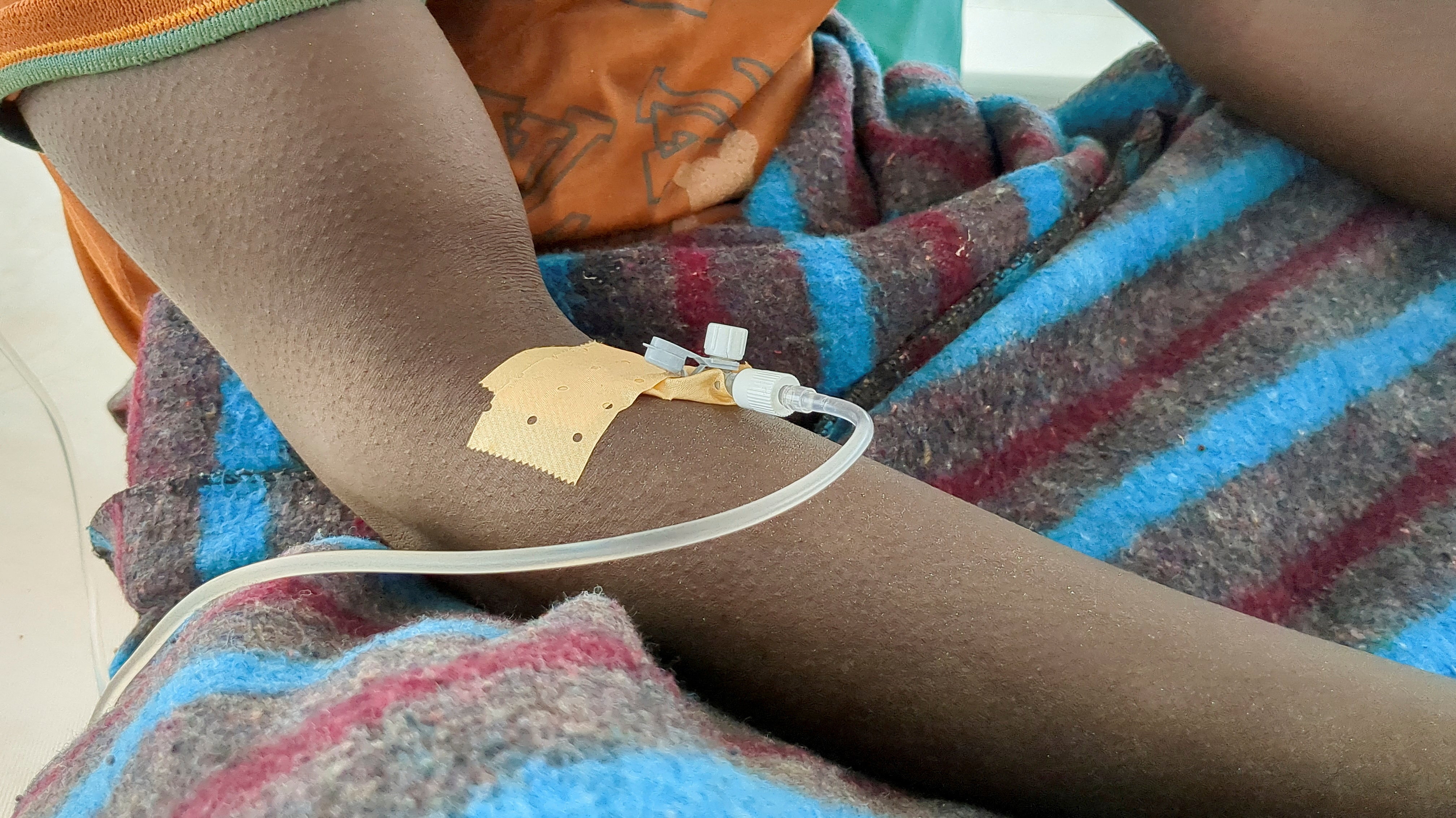 A cholera outbreak in Congo has killed almost 2,000 people since January