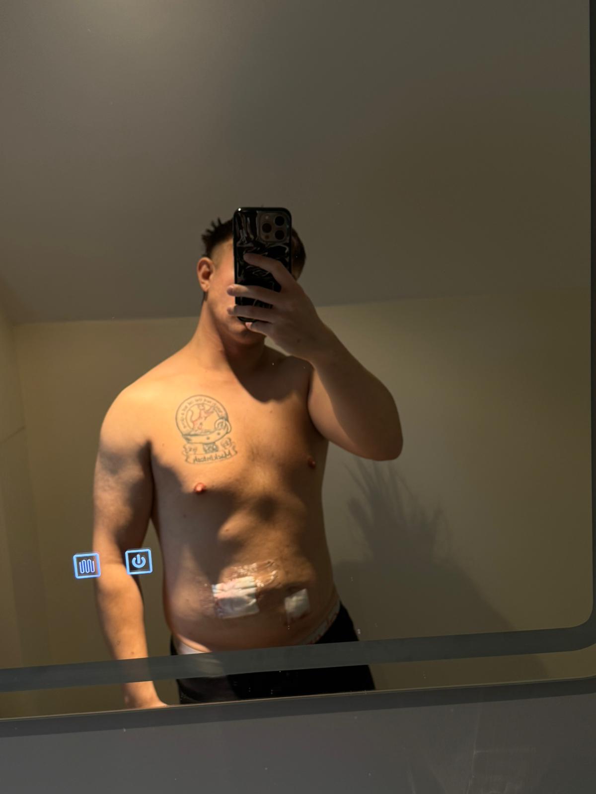 Dan Mackintosh in the aftermath of his surgery