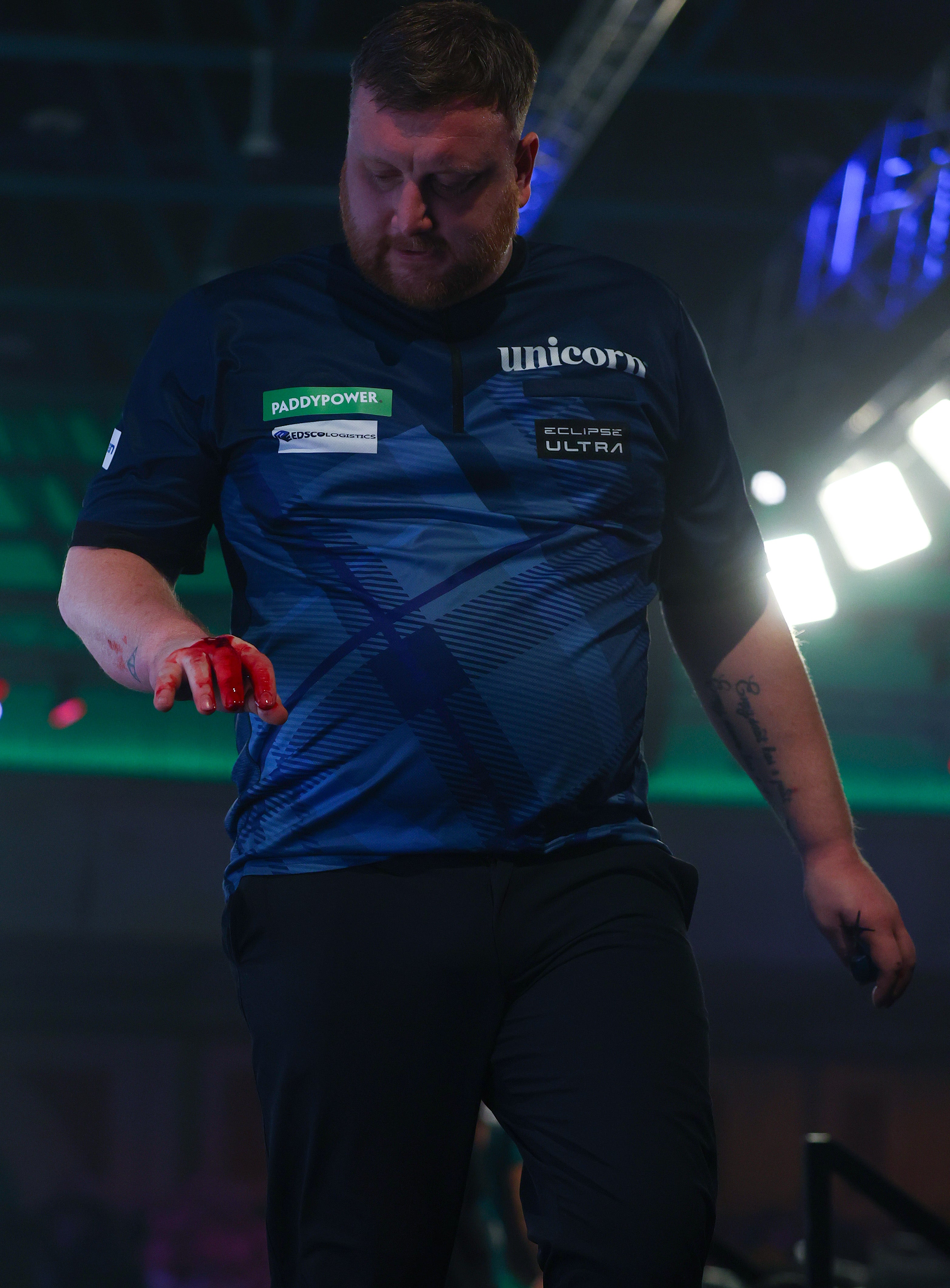 Cameron Menzies of Scotland walks off the stage with a deep cut sustained in his right fist after punching the drinks stand in anger