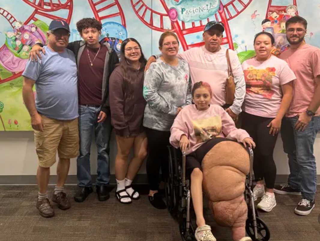 Since the age of two, Jasmine Ramirez, has had a condition that has caused her left leg to grow much faster than the rest of her body. The condition is so rare that doctors do not have a name for it