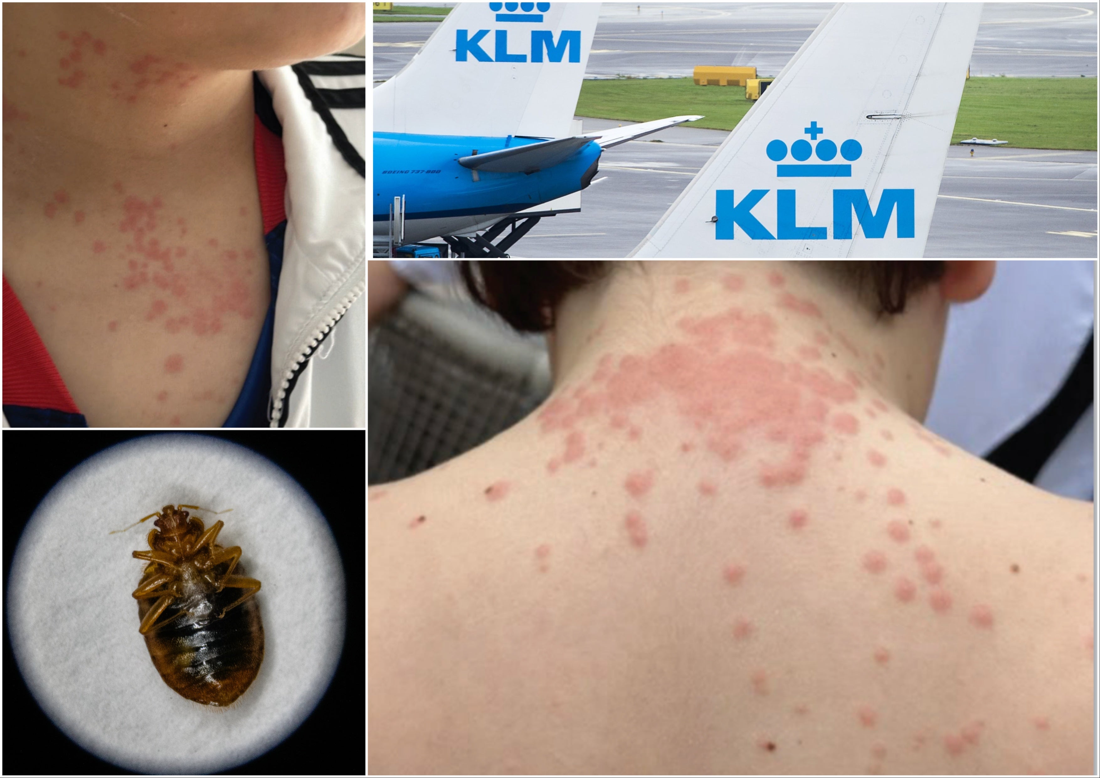 A Virginia family says their vacation was over before it even began, thanks to an alleged bed bug infestation aboard their plane. Now they're suing over their ruined trip