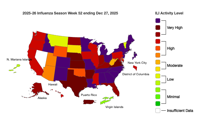 A CDC flu map shows the states reporting the highest level of flu activity, with 30 states now reporting ‘very high’ activity