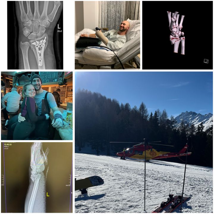Ryan P was awarded third prize after he recounted his tale of badly fracturing his wrist two hours into a snowboarding vacation in Austria. This picture shows the moment a helicopter arrived to fly him to hospital