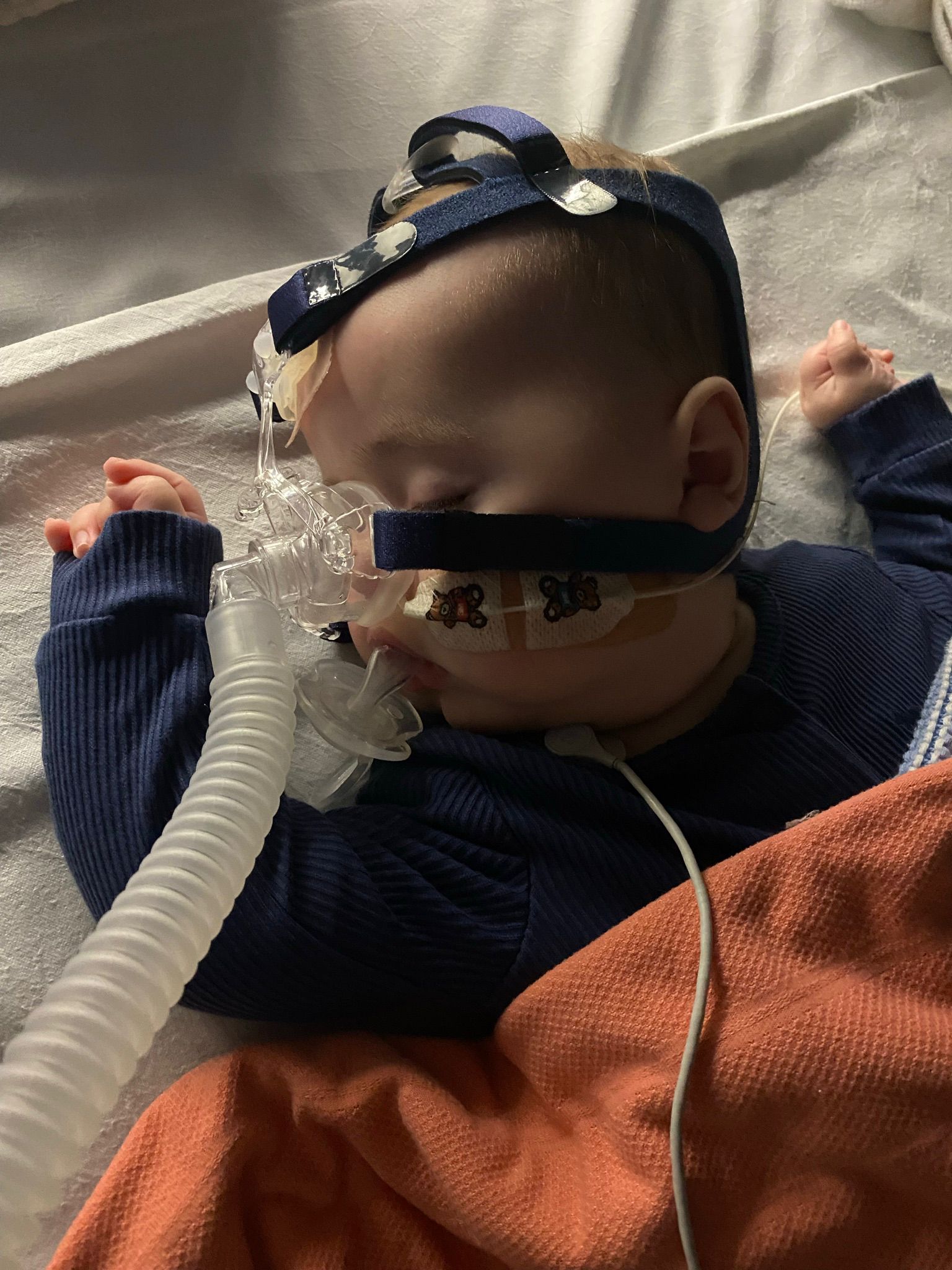 Sid initially required the use of a ventilator before treatment