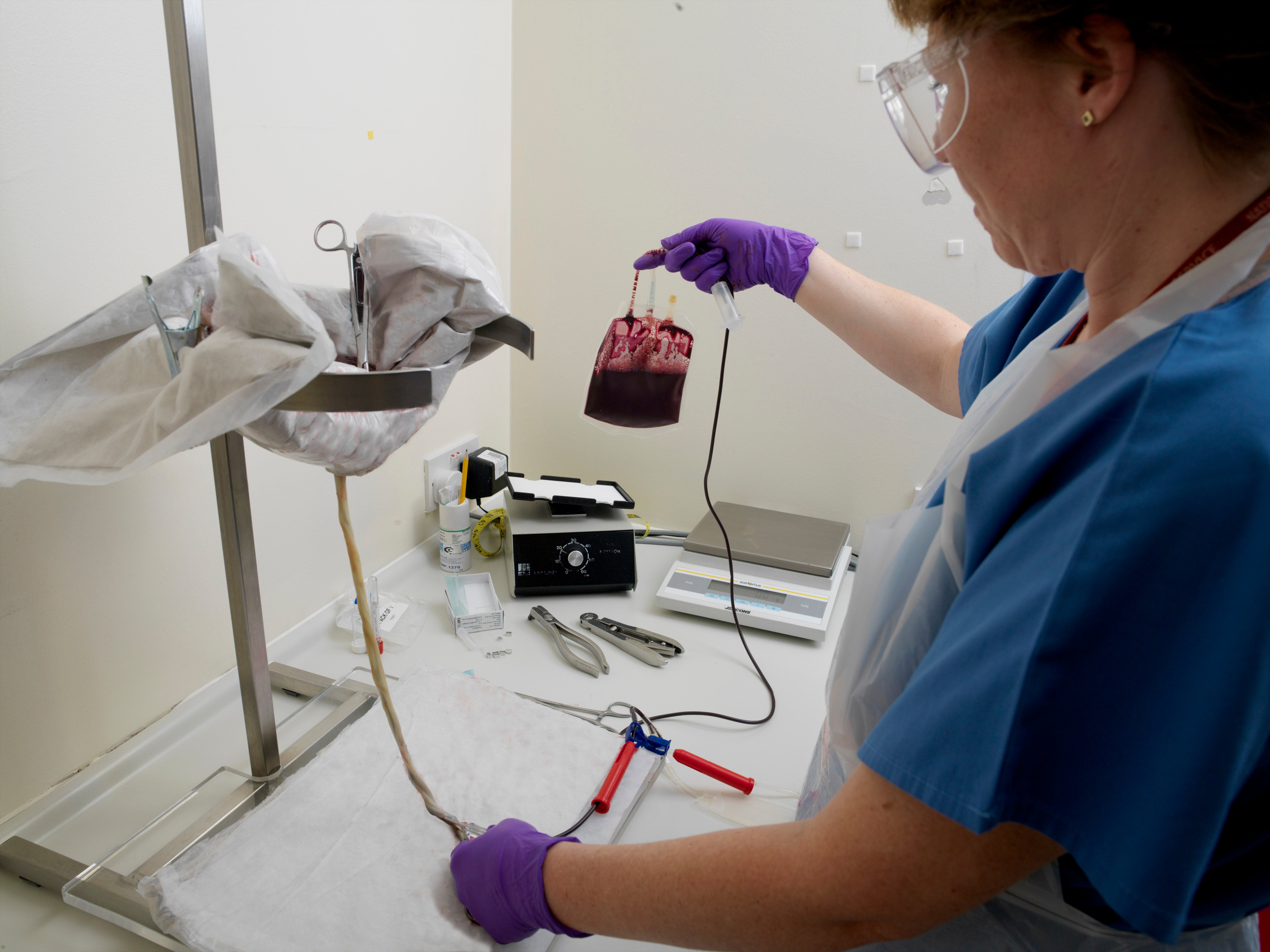 Cord blood is rich in stem cells and is found in the placenta and umbilical cord after a baby’s birth