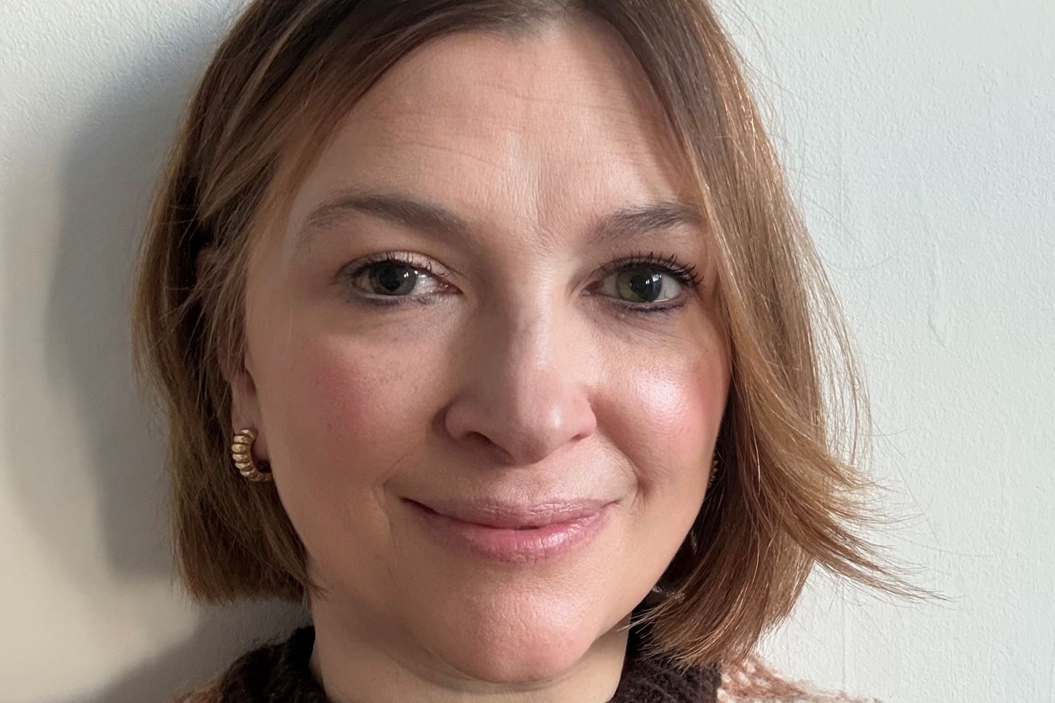 Nicki Guy took part in a study for a new treatment for hypotony (Nicki Guy/PA)