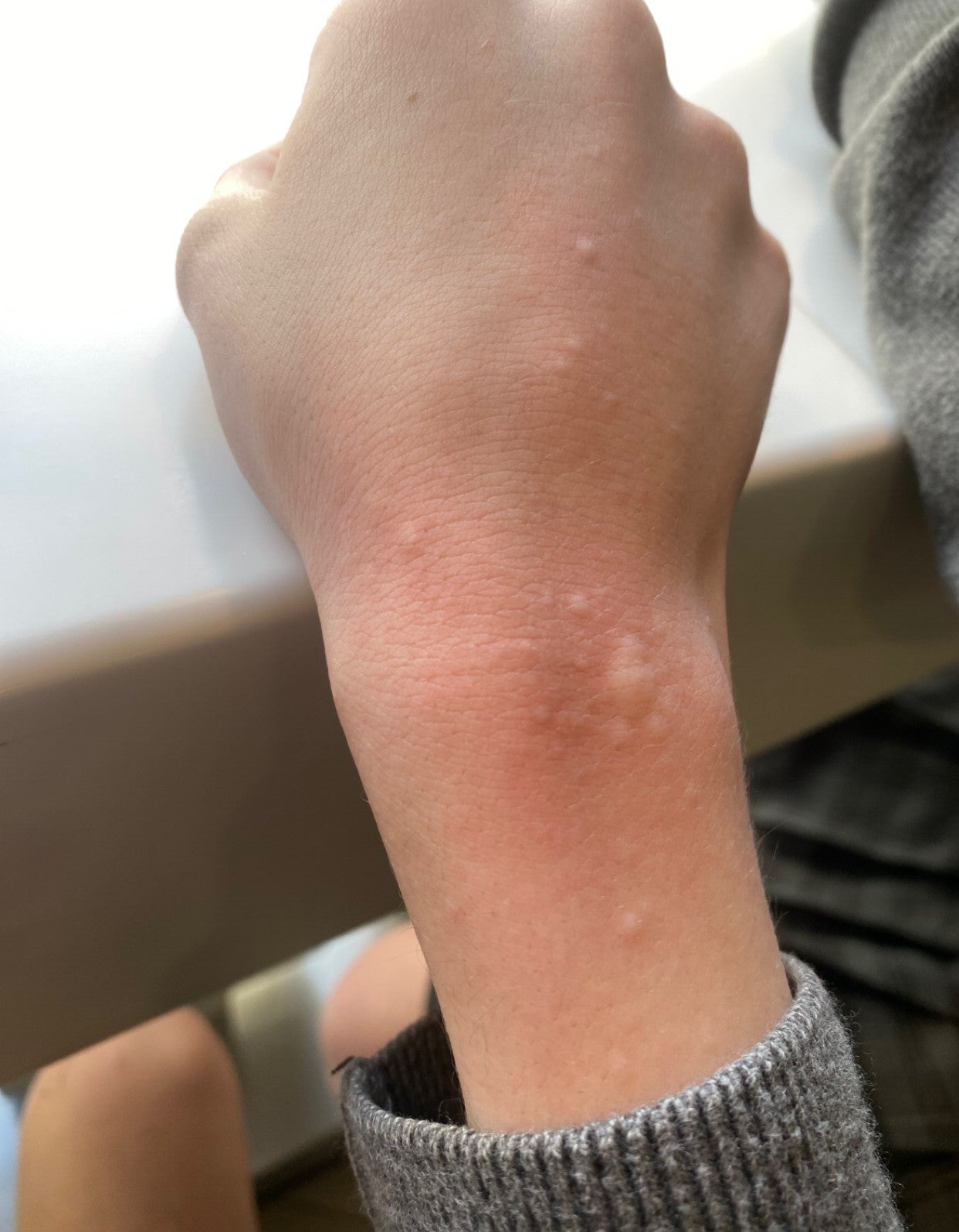 Amber is often self-conscious and work and school