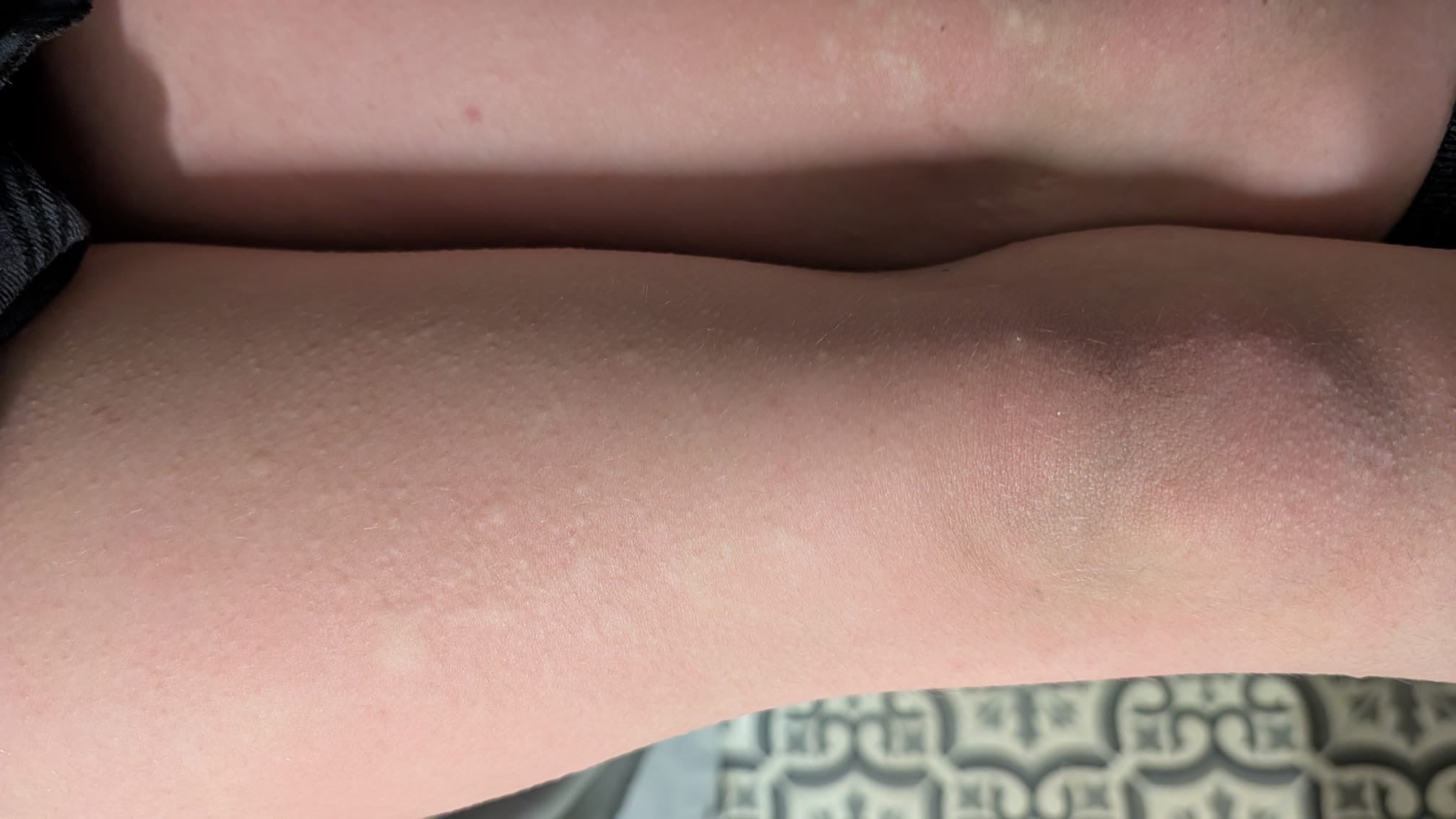 Amber wants to live a ‘normal life’