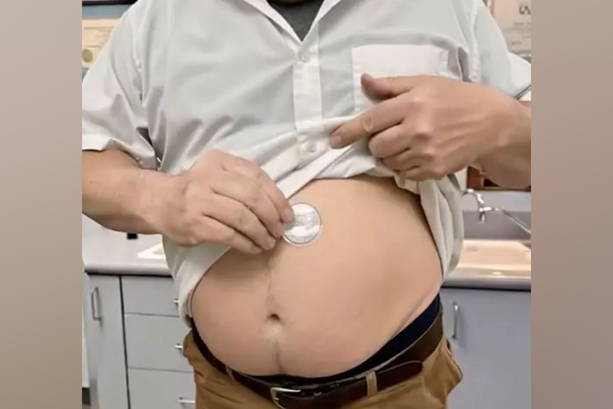 A ‘fraudulent’ video appears to show doctors applying weight loss patches outside the hospital
