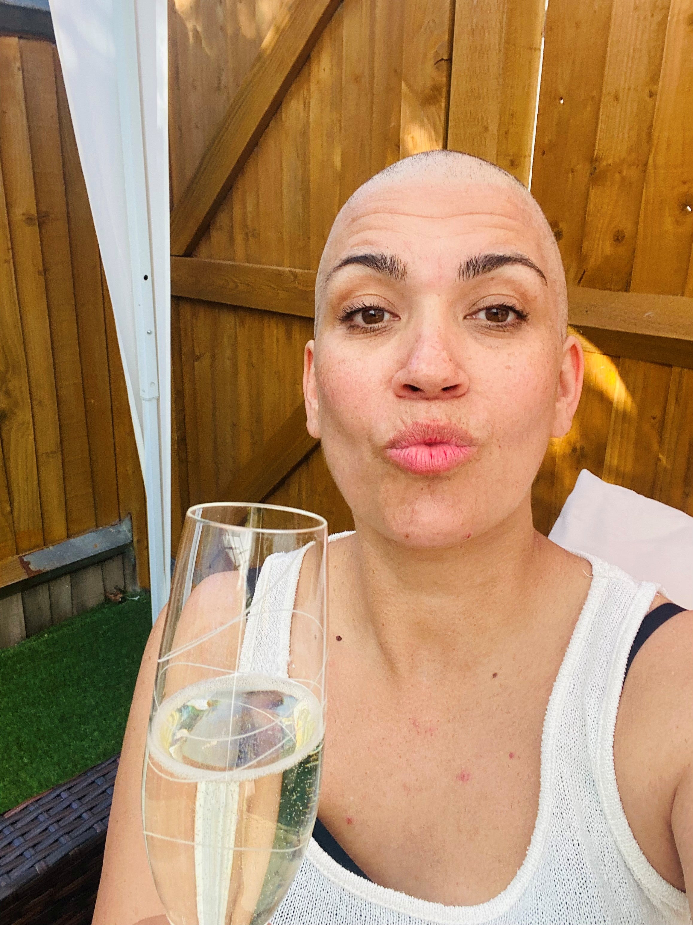 Vicki depois de raspar a cabeça.