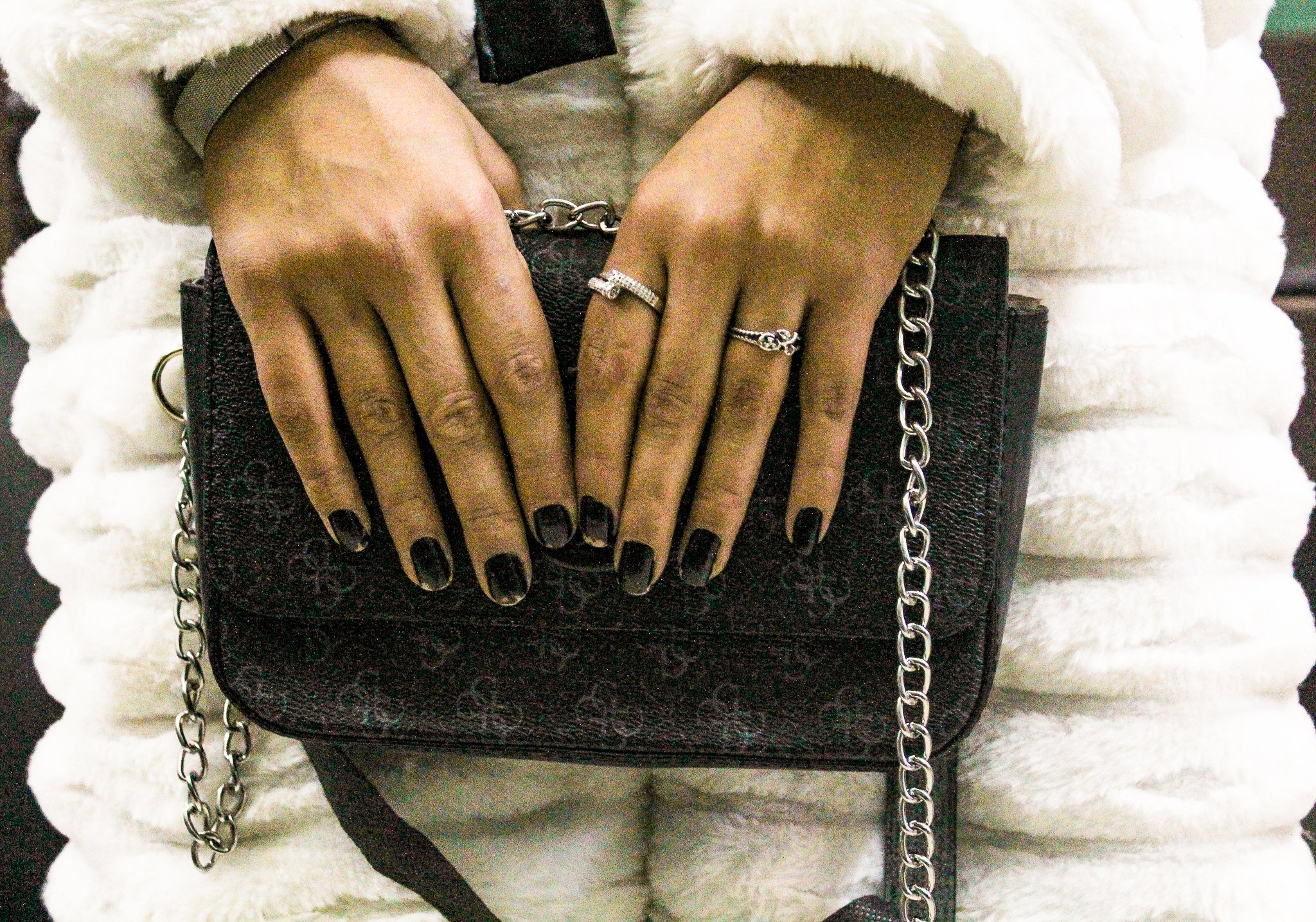 A close up of 21-year-old Noor's hands