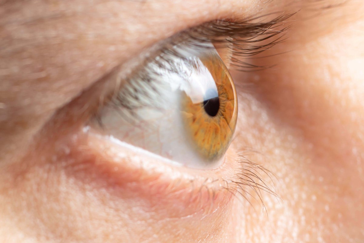 What is glaucoma and what are the main symptoms to look out for? What is glaucoma and what are the main symptoms to look out for?