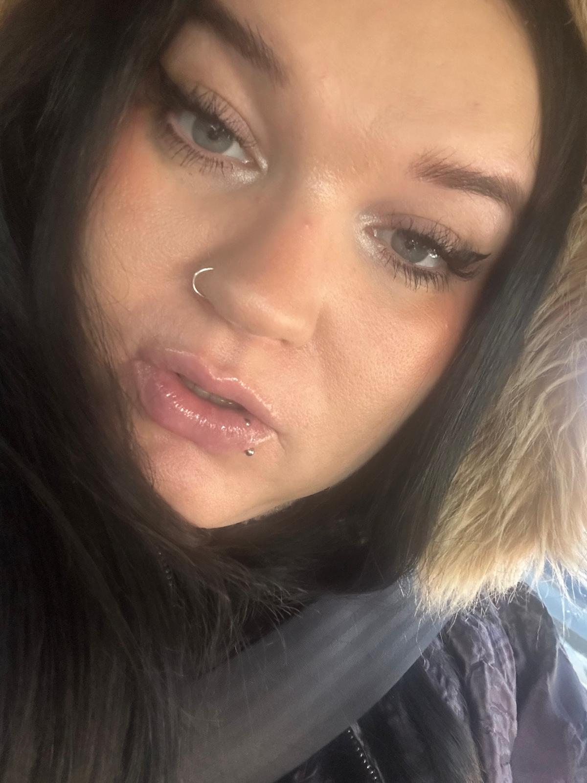 Kelly Gordon, pictured, was 2 when she was diagnosed with SMA Type 3