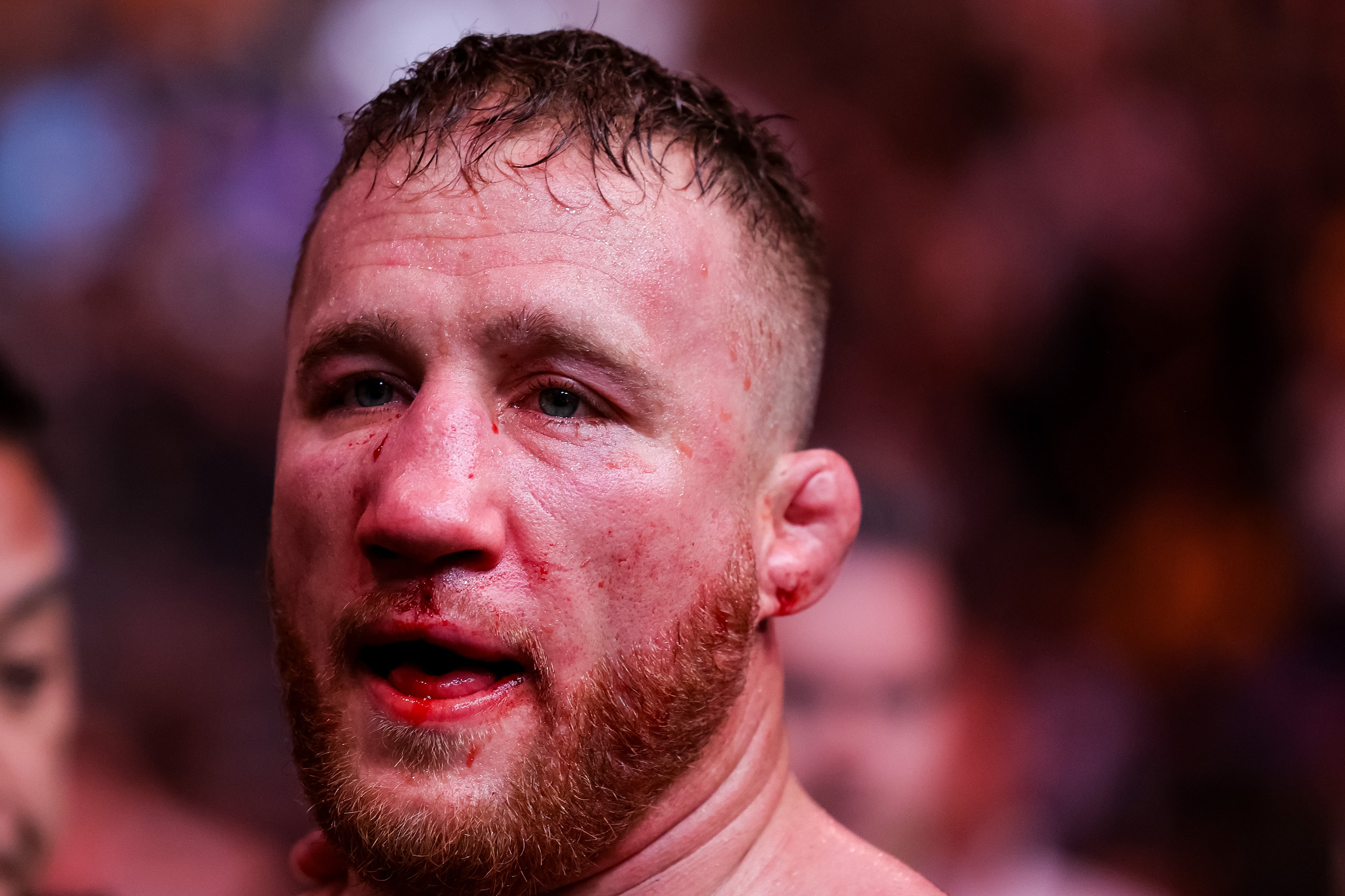 Justin Gaethje after his 2024 knockout loss to Max Holloway