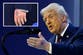 Huge bruise spotted on Trump’s other hand as he delivers speech in Davos
