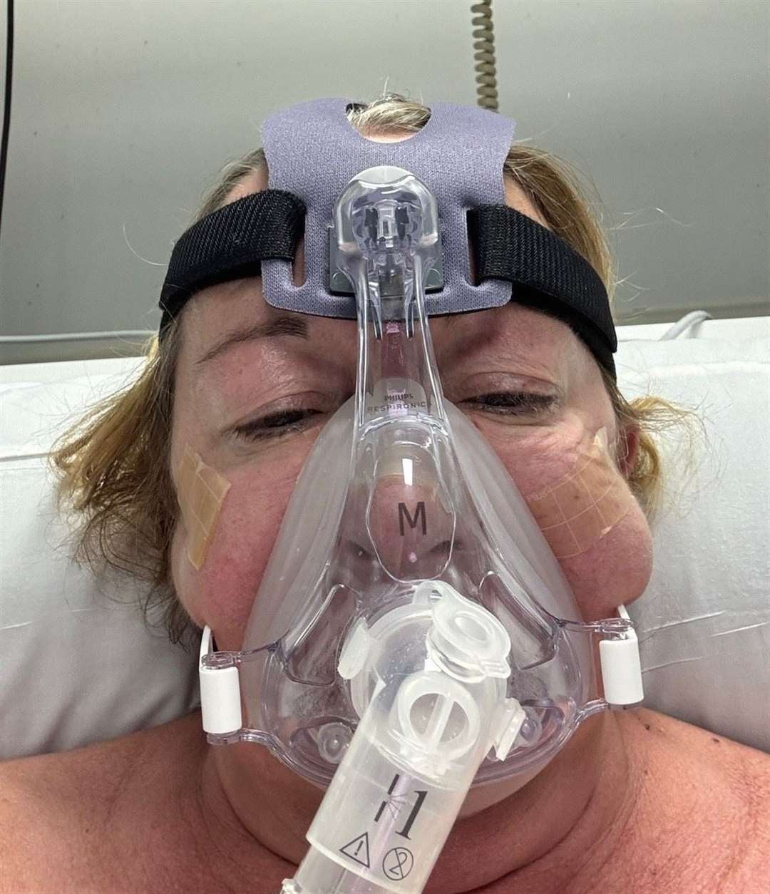 <p>Juliet Leith spent 12 days in the ICU after developing flu-like symptoms, joint pain and breathlessness while staying at a four-star Tui hotel</p>