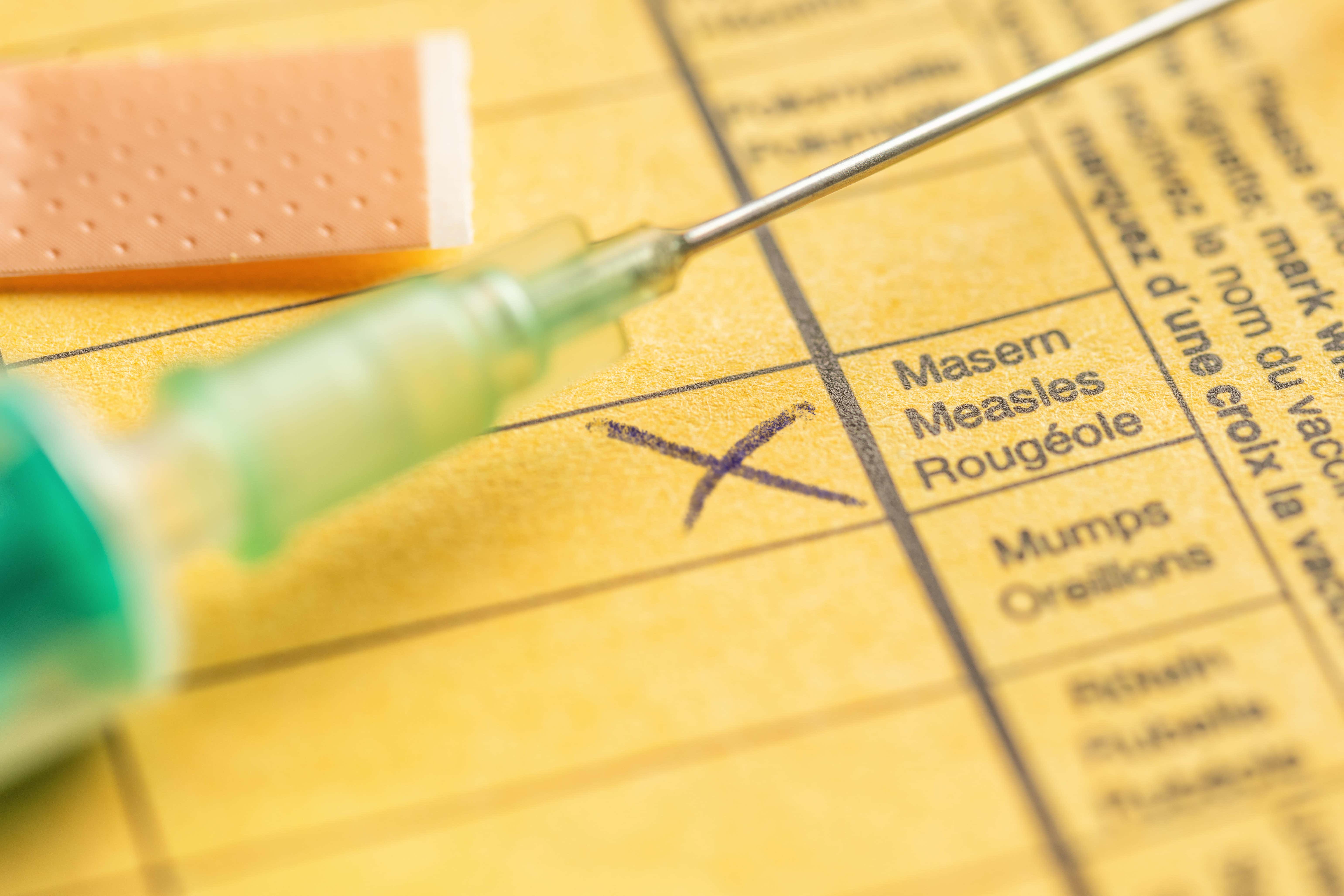 Measles is no longer absent from the UK (Alamy/PA)