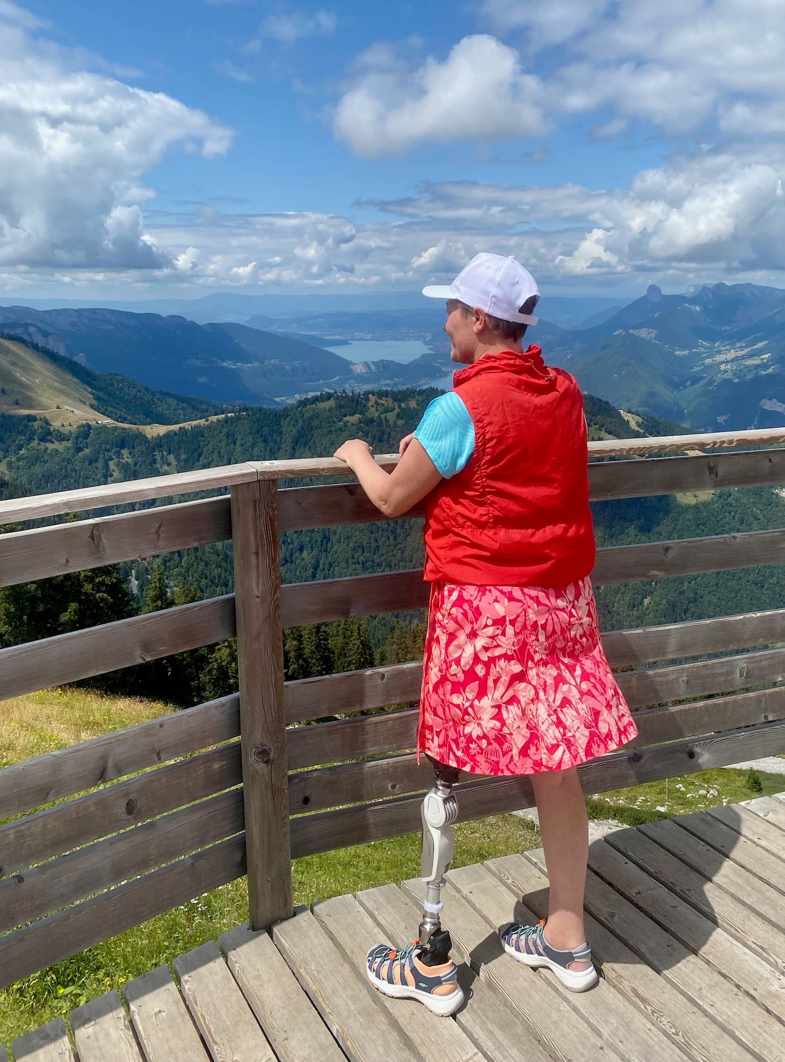 Friedel said she likes to show off her prosthetic