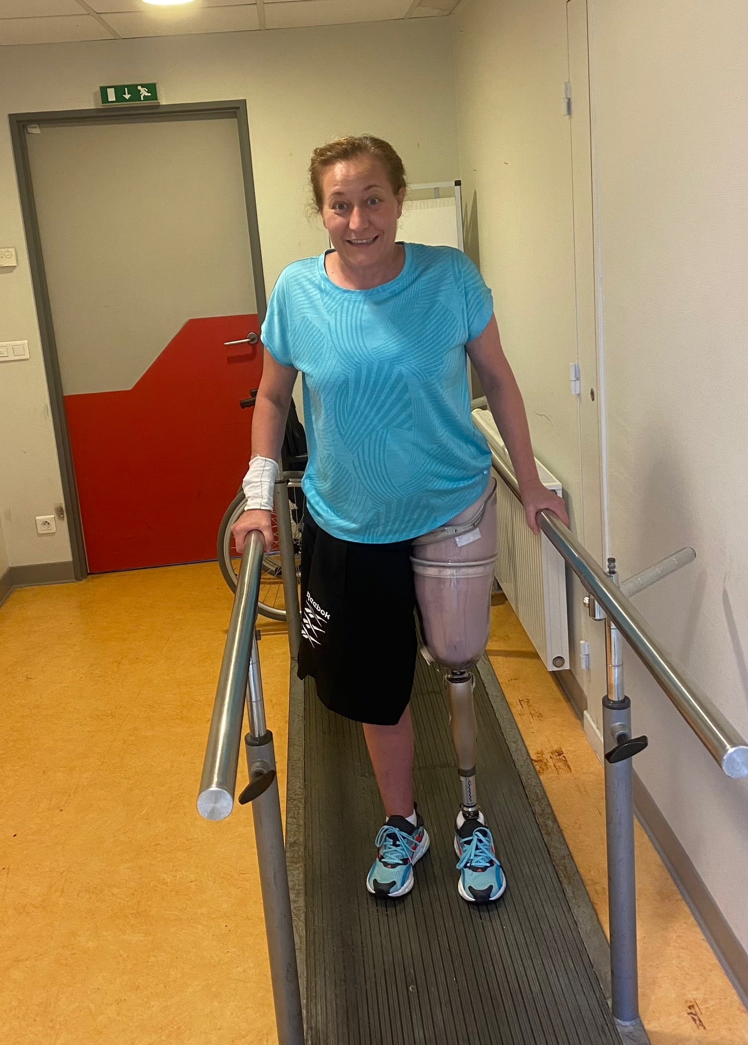 Friedel said she had ‘no problem’ with the amputation at first