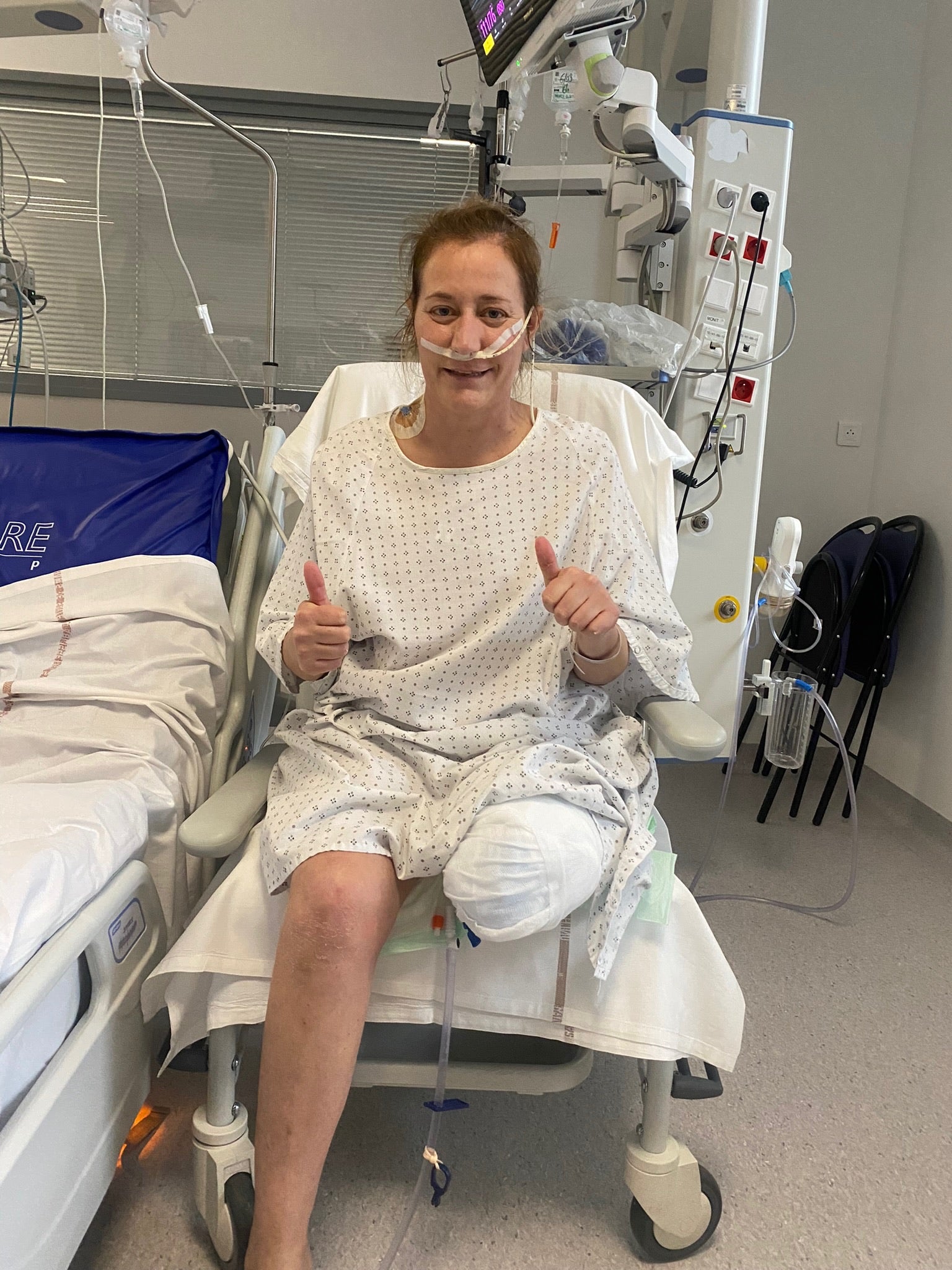 Friedel’s leg had to be amputated to remove the infection