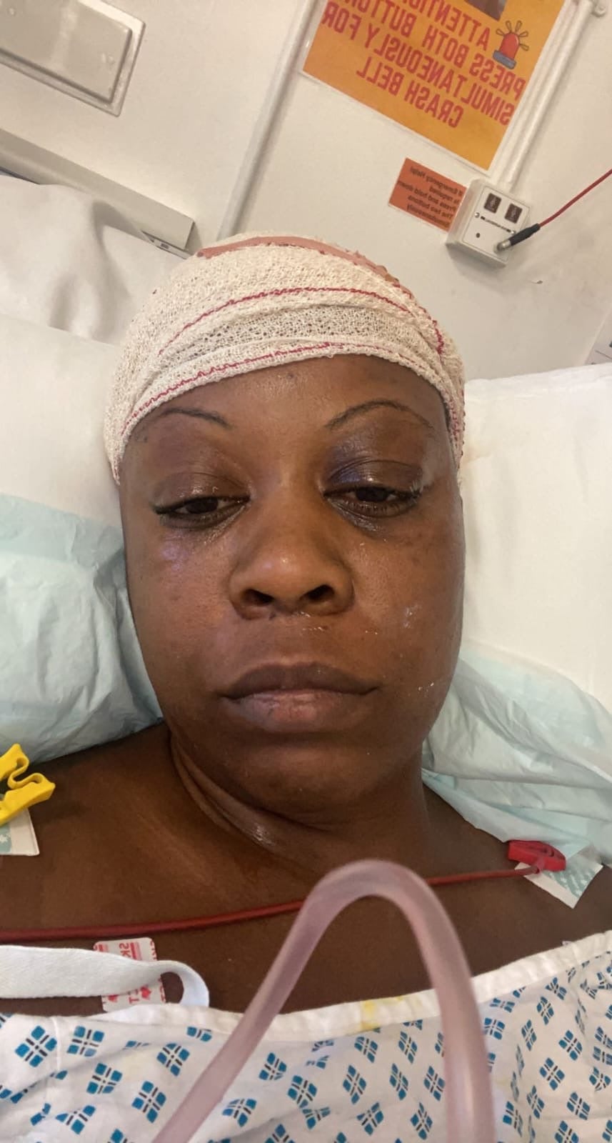 Natasha had her first stroke in 2022 after experiencing headaches