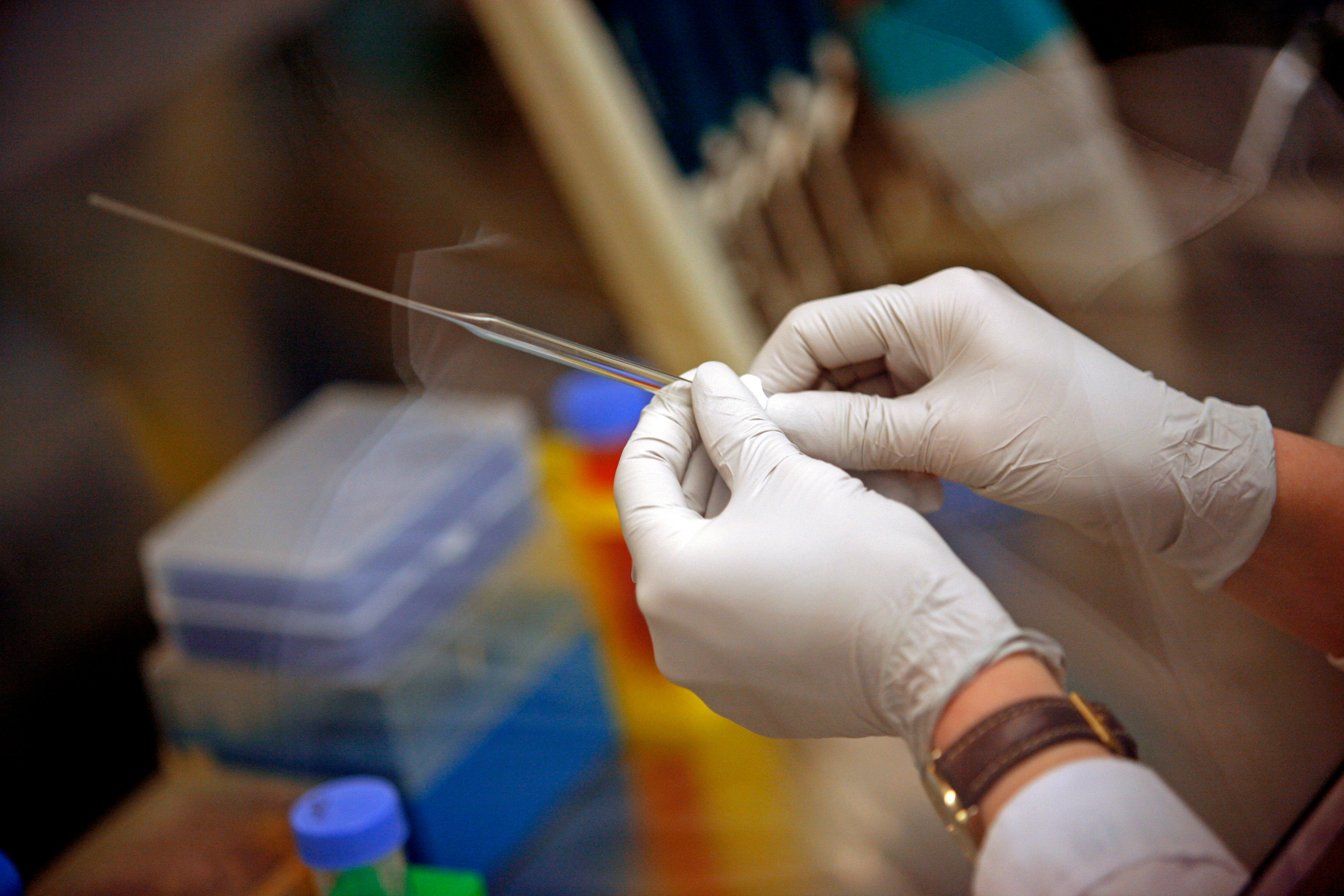 A new kind of stem cell therapy could help ease symptoms of people living with Parkinson’s disease, Southern California researchers say