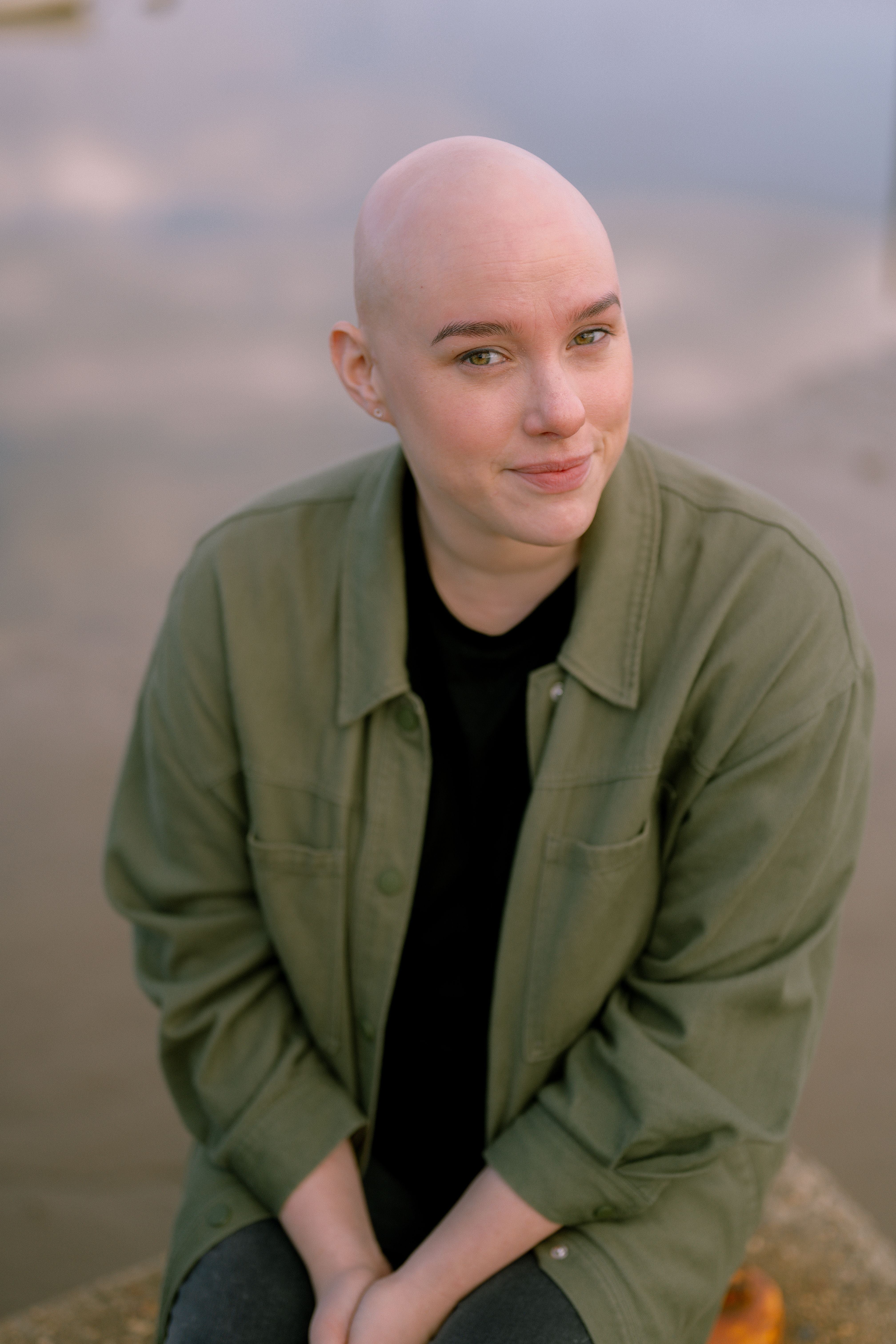 Laura Mathias is now a visible differences campaigner