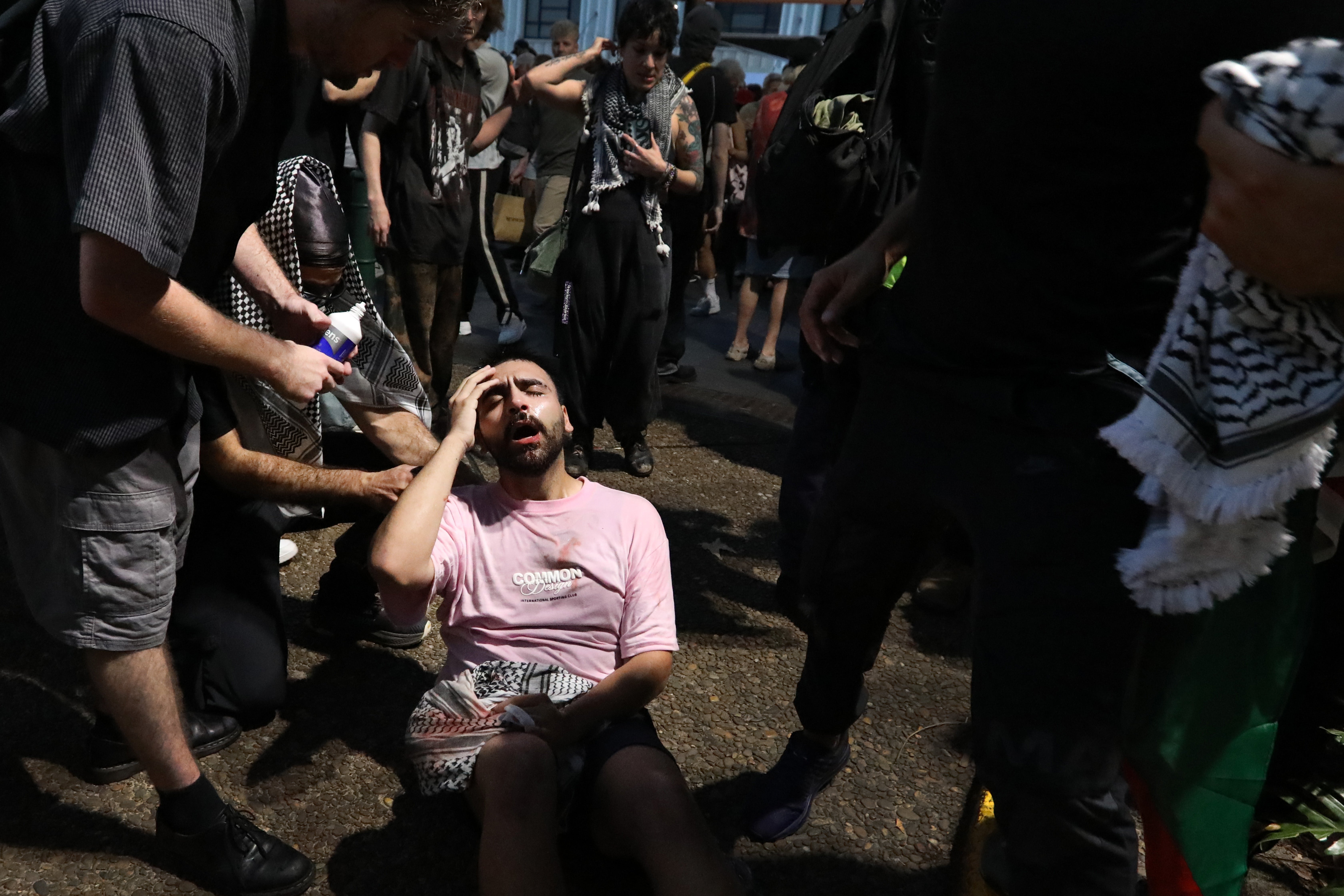 A protester receives assistance after being pepper-sprayed by police