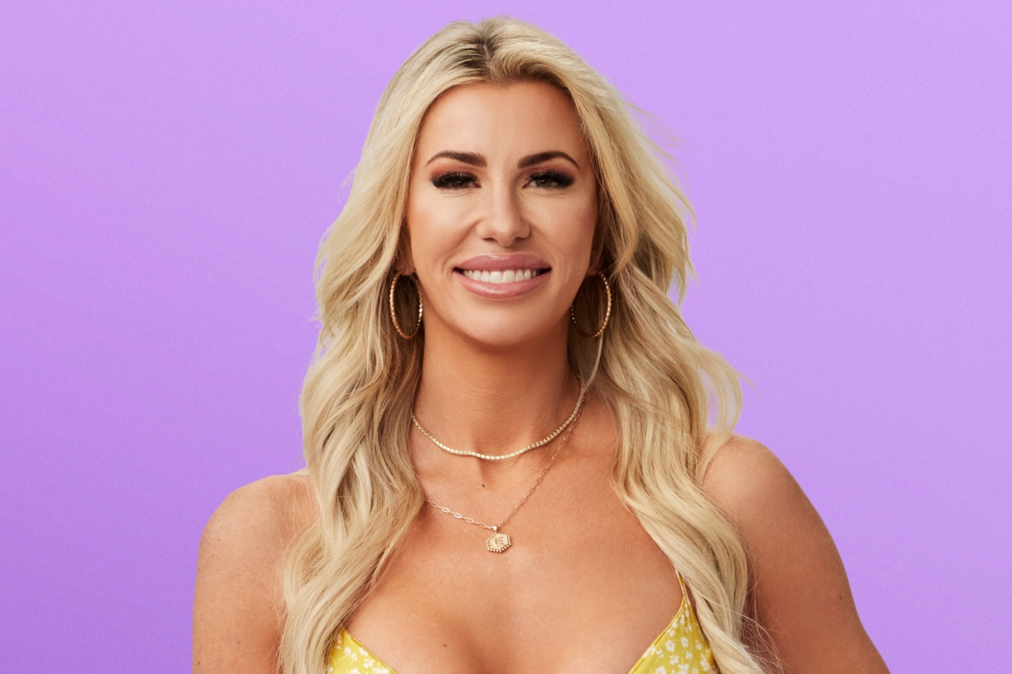 <p>Elissa Finley accidentally picked up a bottle of nail glue between dates, thinking it was eye drops, resulting in her being sent to the hospital to get her eyes flushed</p>