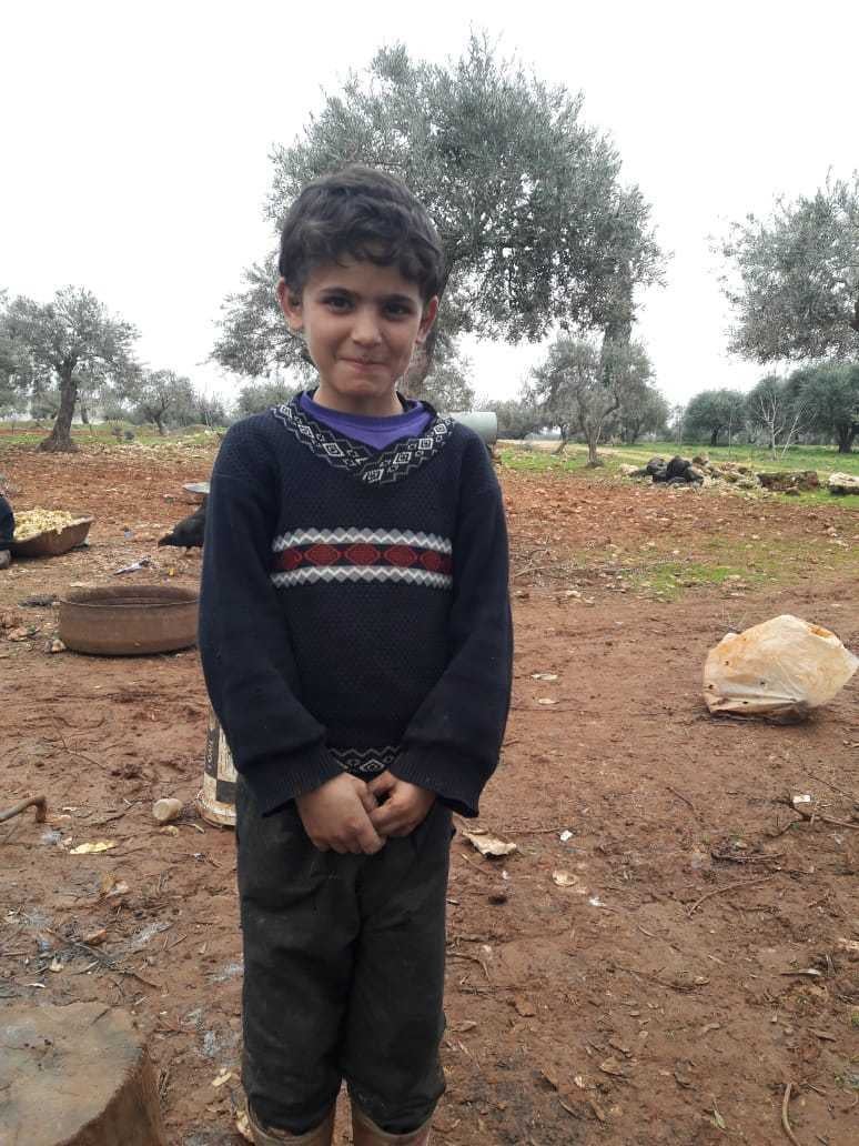 Ibrahim, 12, suffered shrapnel wounds as deep as his bones