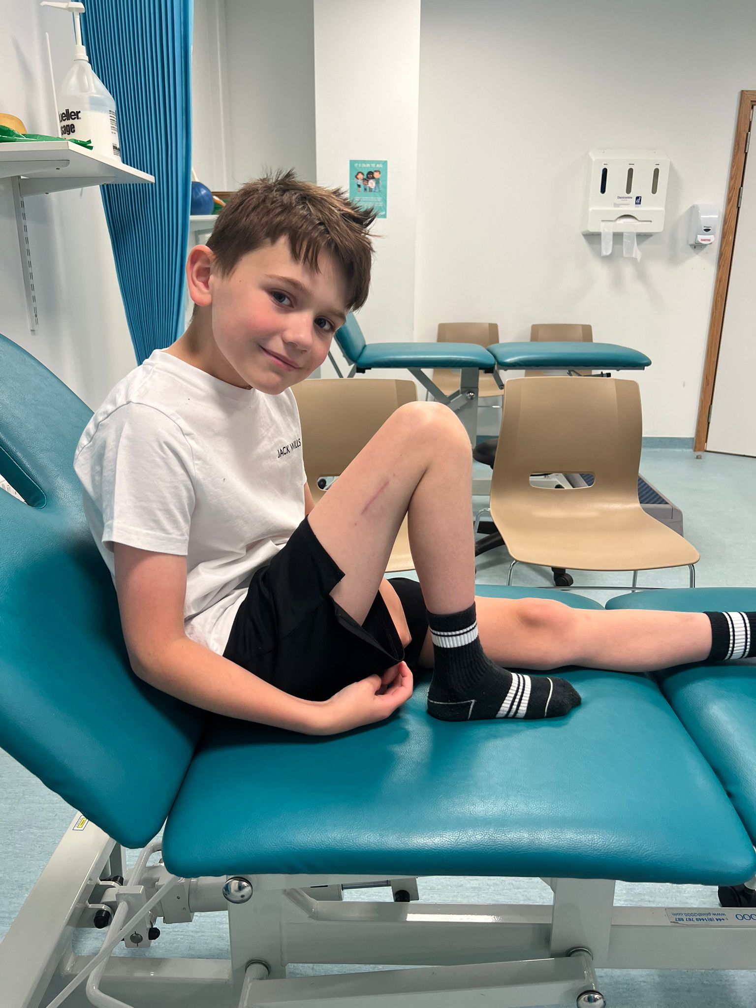 Alfie’s scar following his surgery (Laura Ducker/PA)