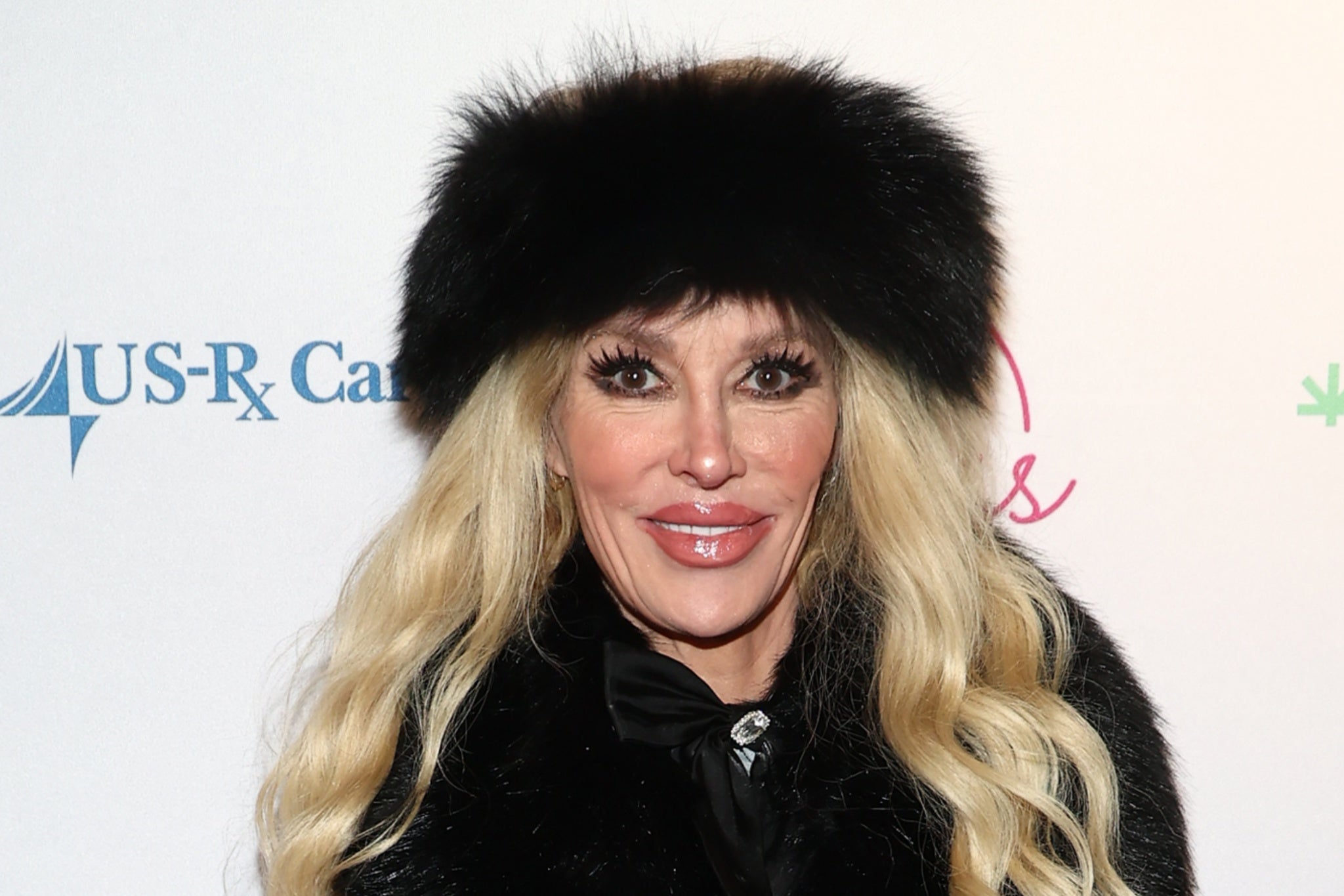 <p>Brandi Glanville reveals what cause her parasite</p>