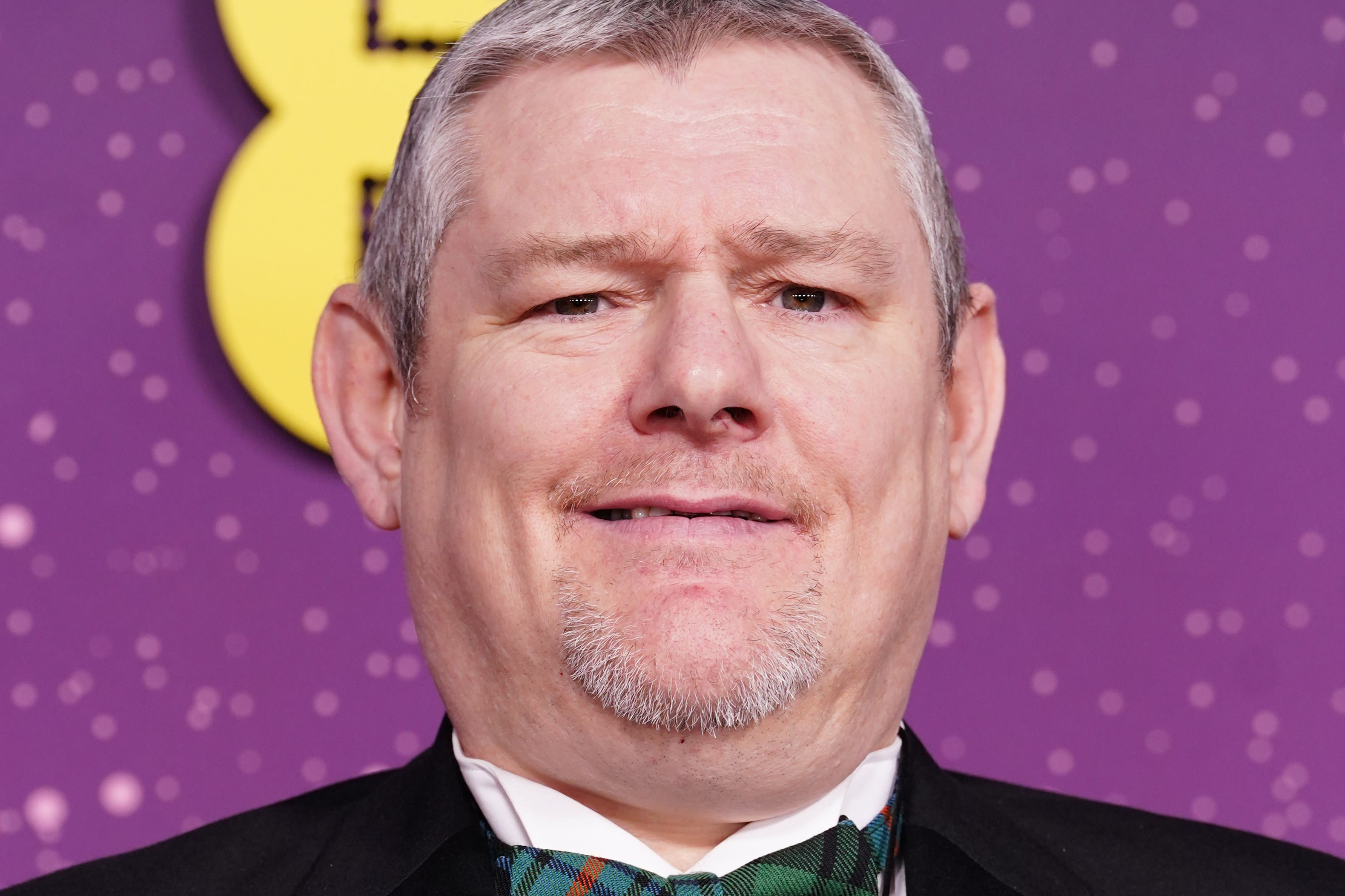 Борац за Туретов синдром Џон Дејвидсон је узвикивао вређање током Бафта у недељу