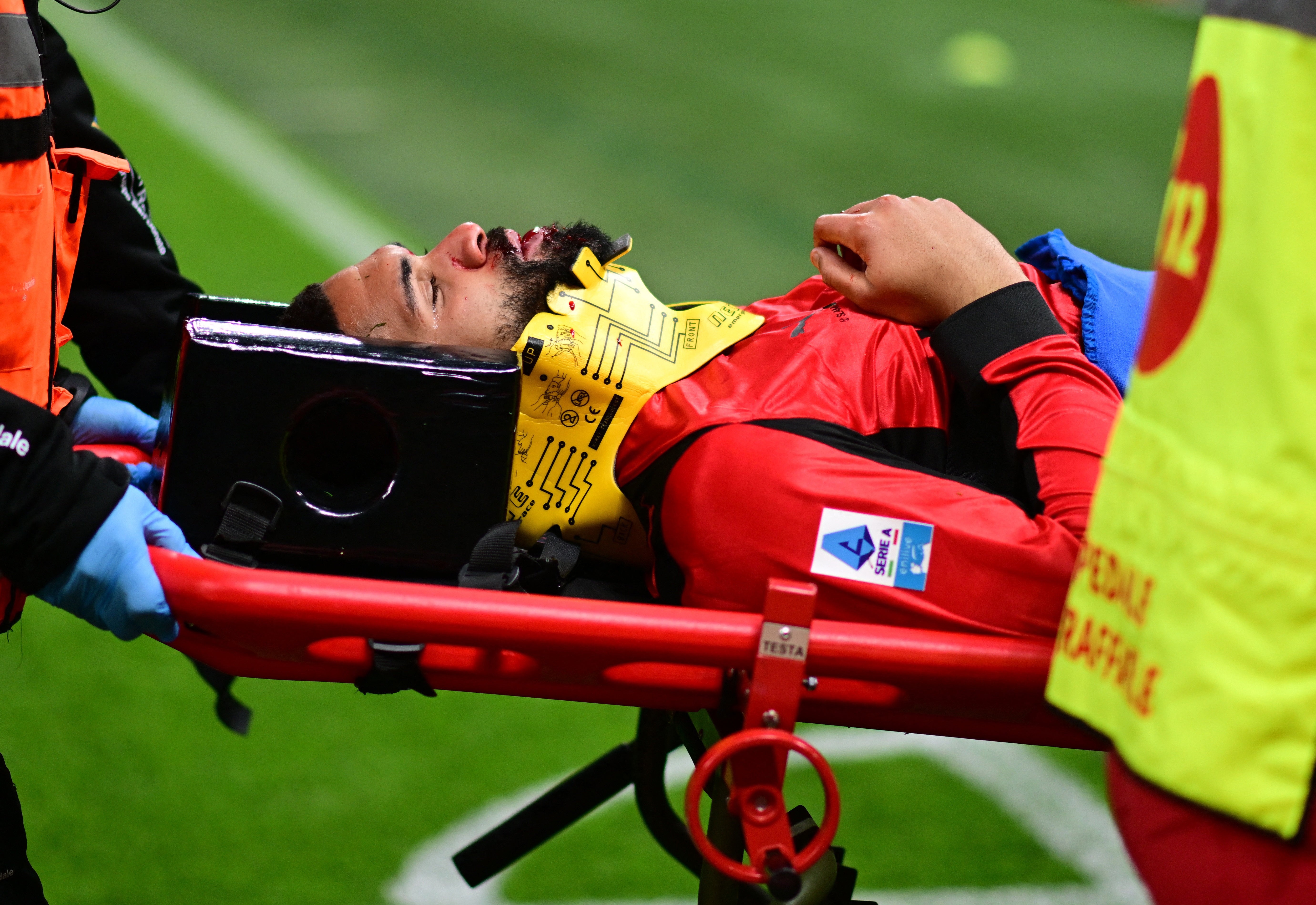 Loftus-Cheek had to be stretchered off