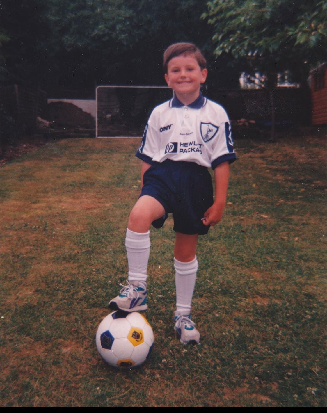 Anthony, aged six, before his brain tumour surgery