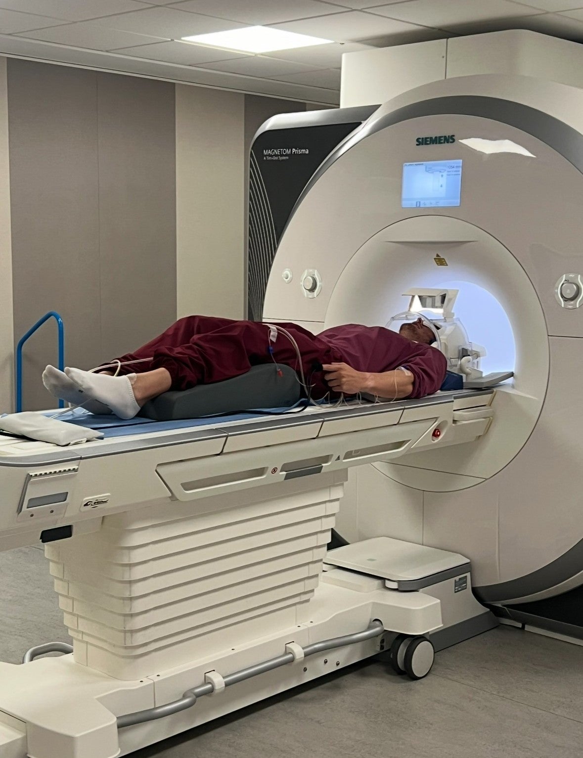 An MRI scan revealed lesions on his brain and spinal cord that indicated MS