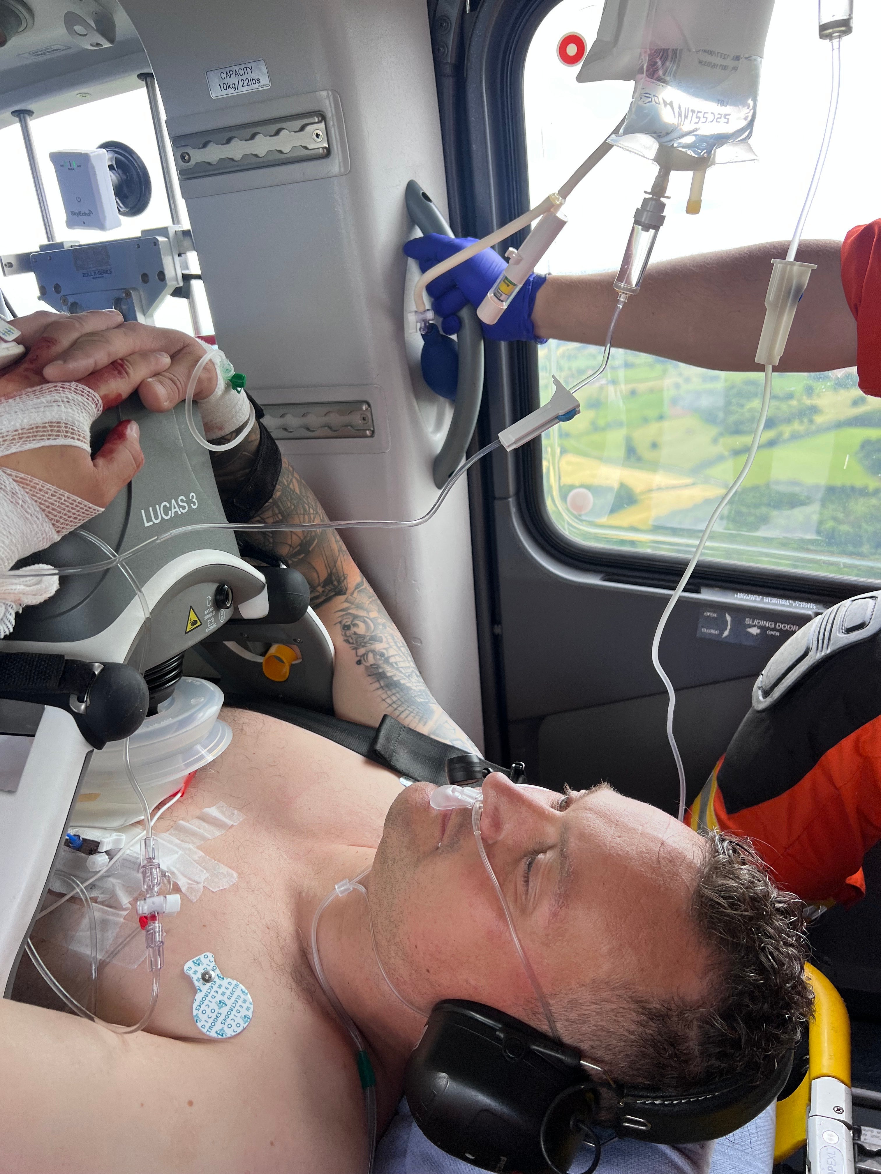 Chris also made some lifestyle changes, the most important of which was quitting smoking.