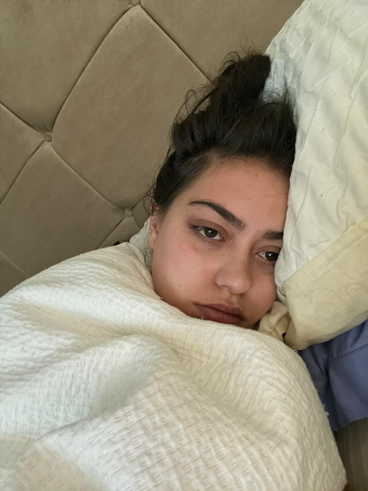 ‘I dismissed my symptoms as food poisoning. Then meningitis almost killed me’