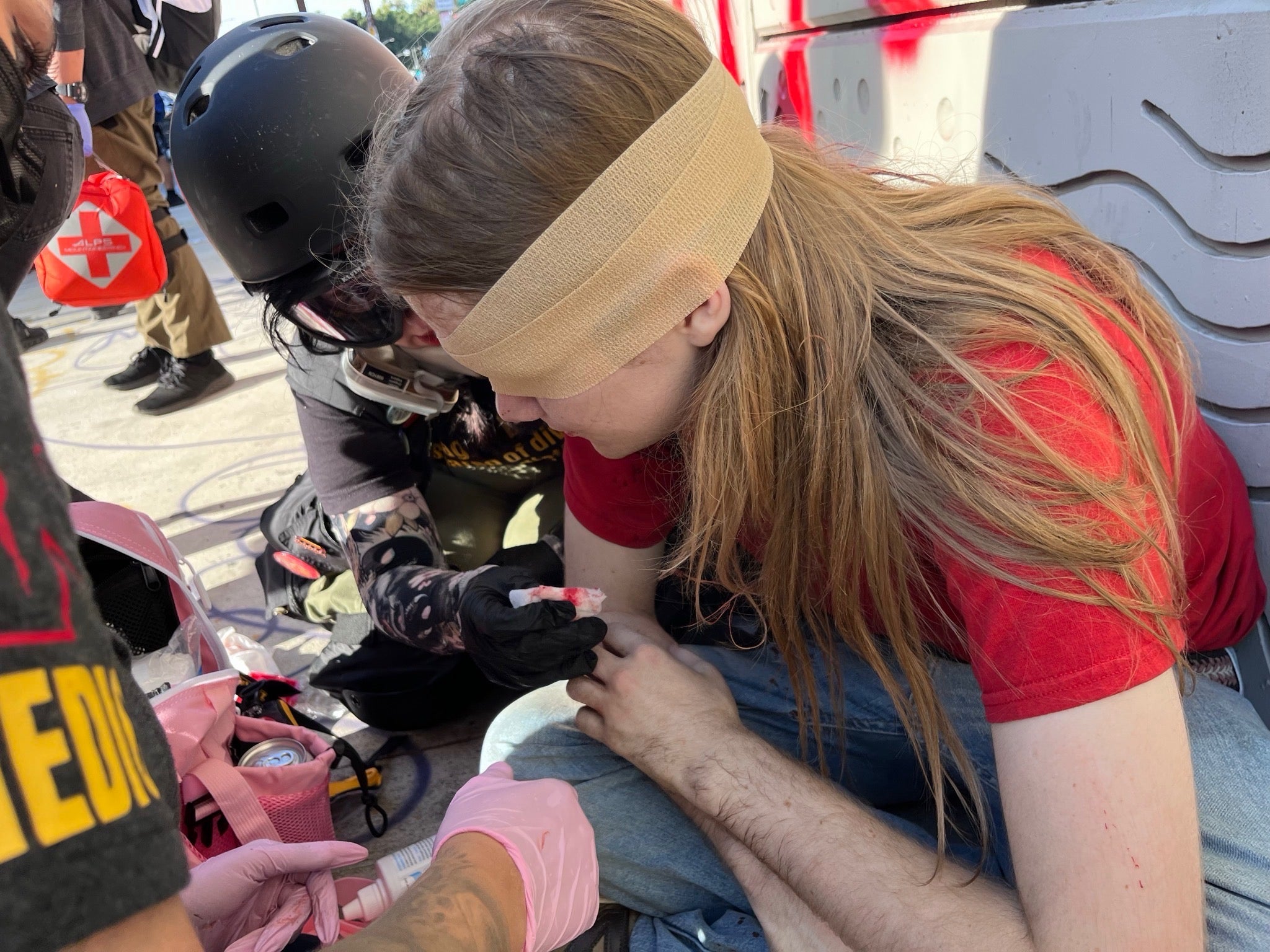 Teen whose eye was surgically removed after DHS shot him files civil rights complaint: ‘I’m in no way an agitator. I just had my camera’