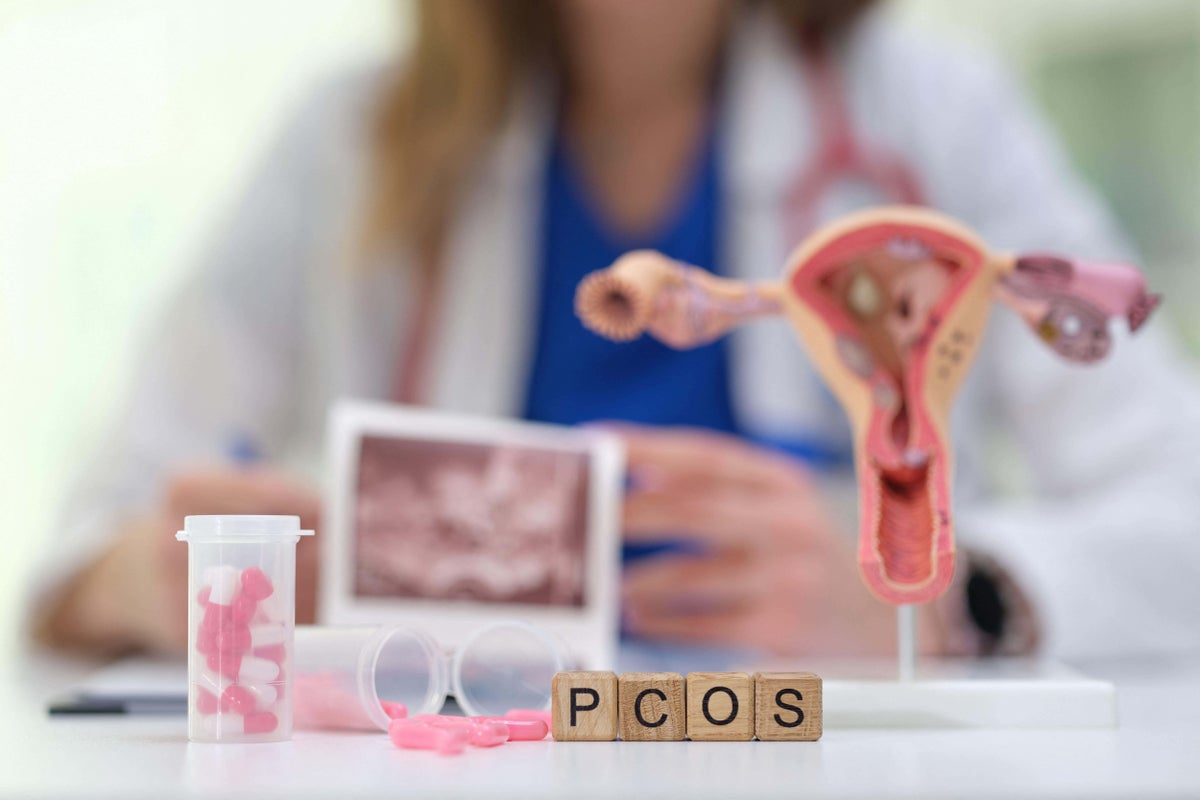 6 early signs of PCOS that are often overlooked 6 early signs of PCOS that are often overlooked