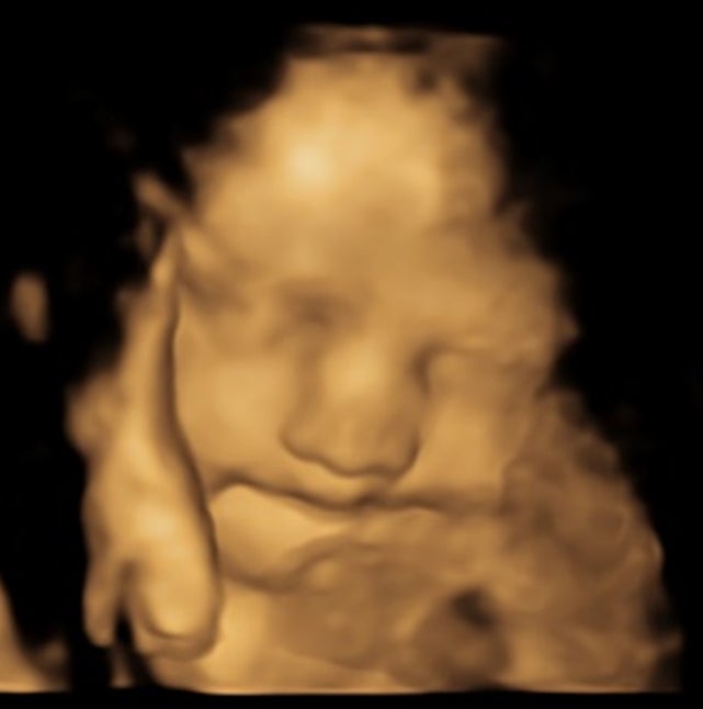 Pregnancy diet shapes children’s vegetable preferences new research reveals  www.the-independent.com