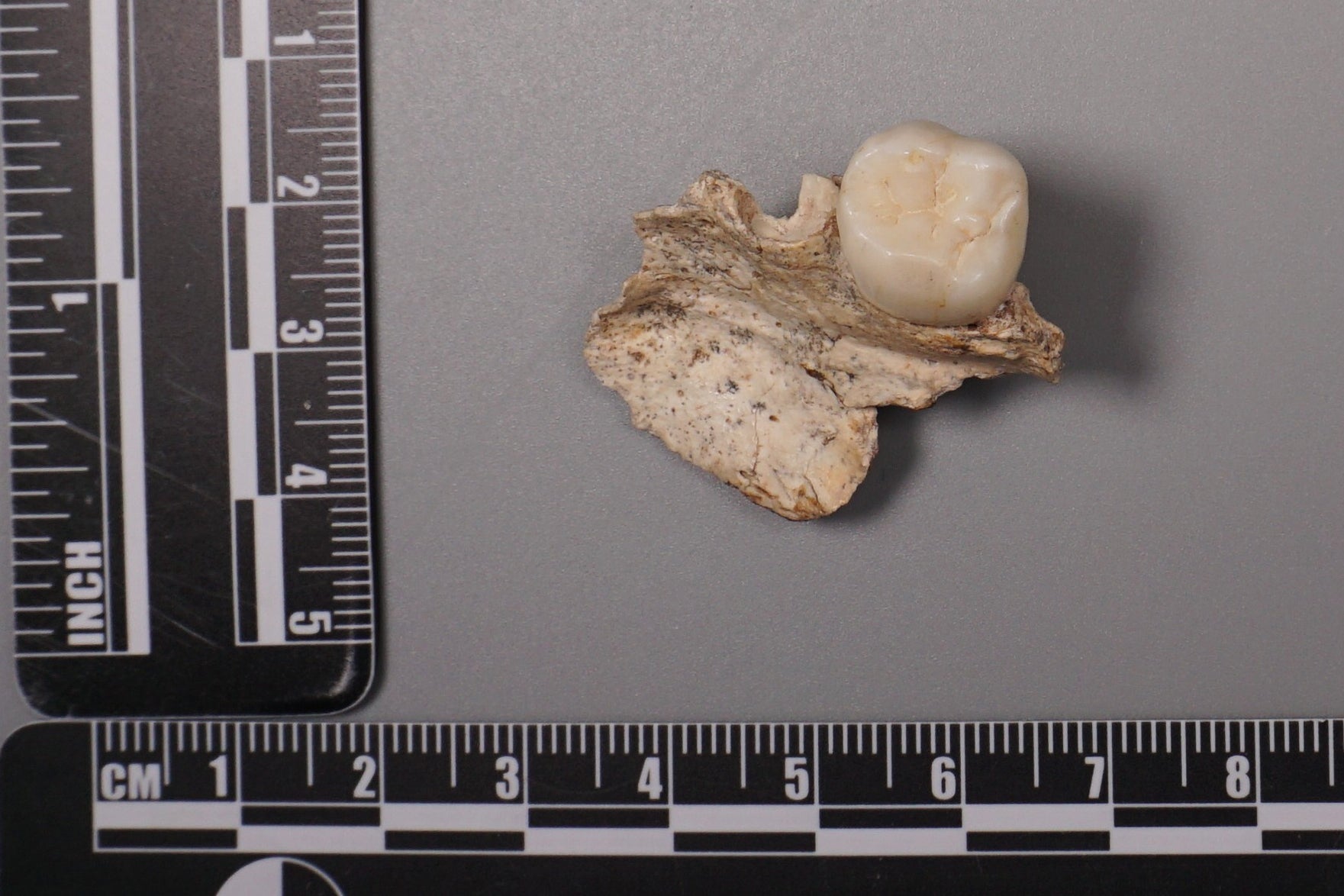 An ancient tooth found at the Sunjiadong archaeological site in China.