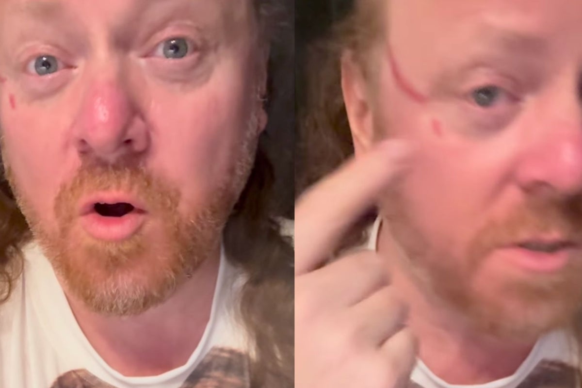 Keith Lemon actor Leigh Francis clawed in face by overzealous fan during DJ set