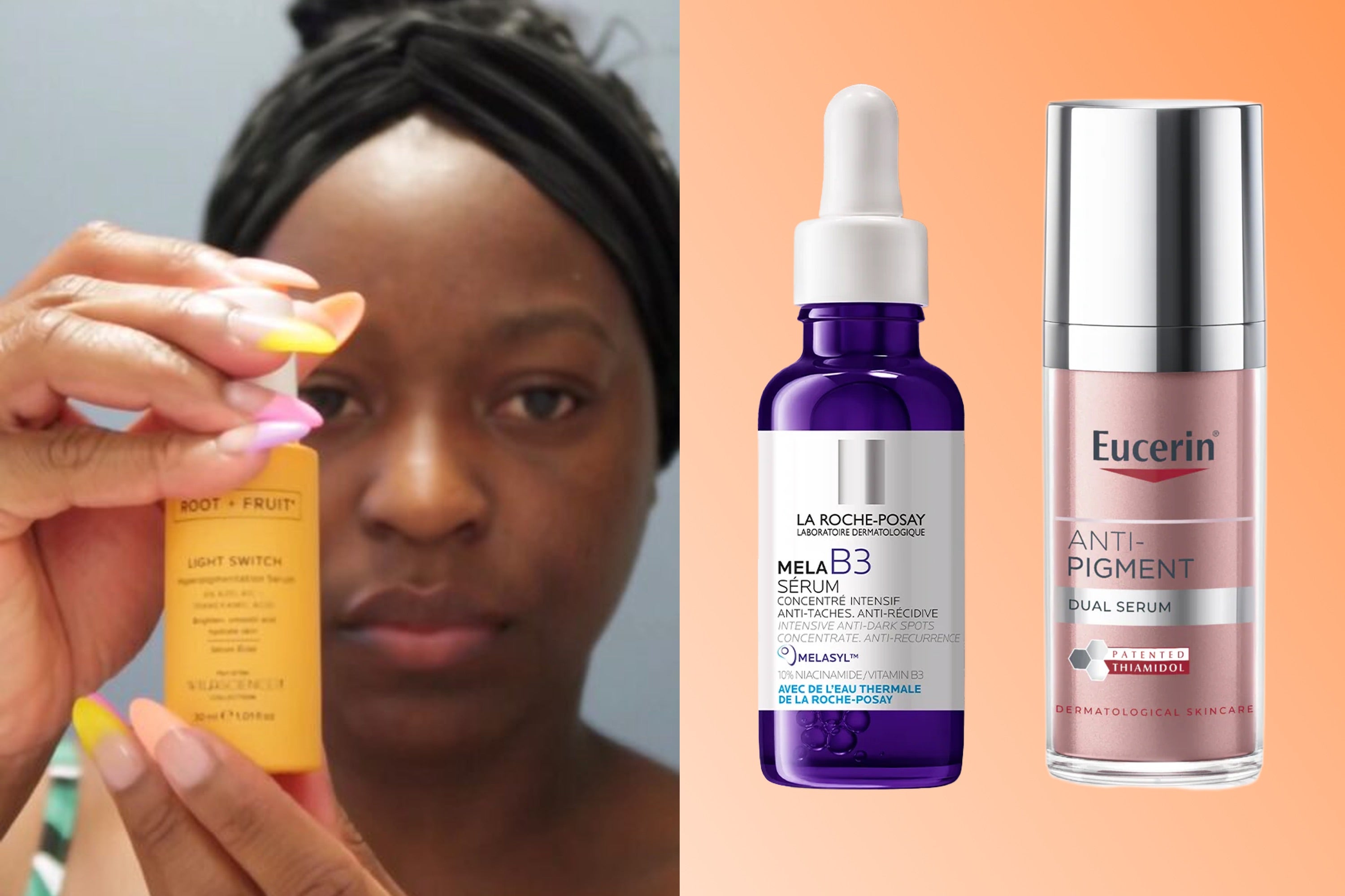 <p>Common types of pigmentation are melasma, post-acne marks and solar lentigines from UV exposure </p>