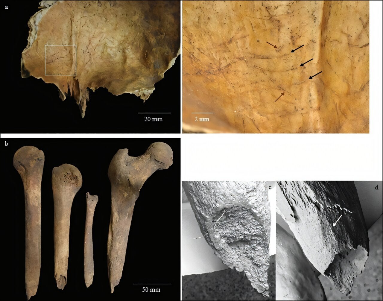 Iron Age Britons likely removed corpse brains in strange funeral ritual