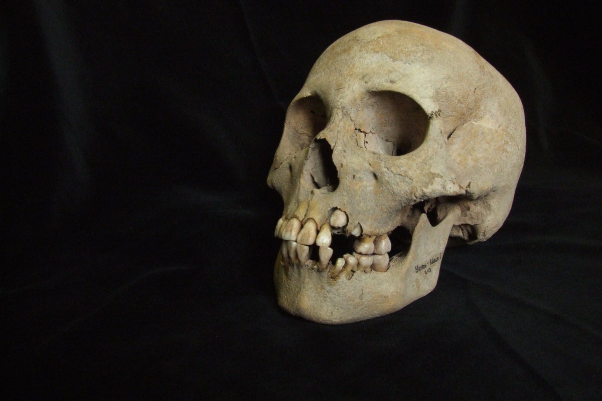 Oldest known evidence of the plague discovered and it transforms what we know about the disease