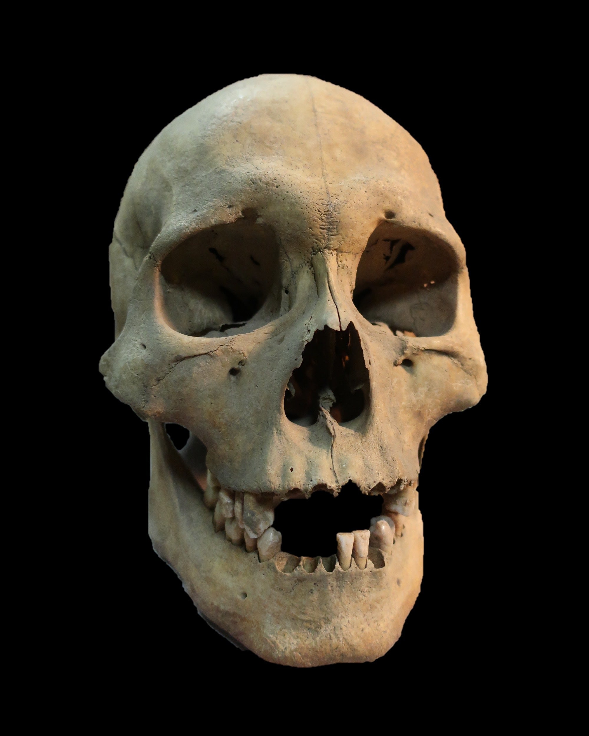 This 2019 image from Angela Lieverse shows the skull of an adult woman who was infected with the plague and was buried in Siberia