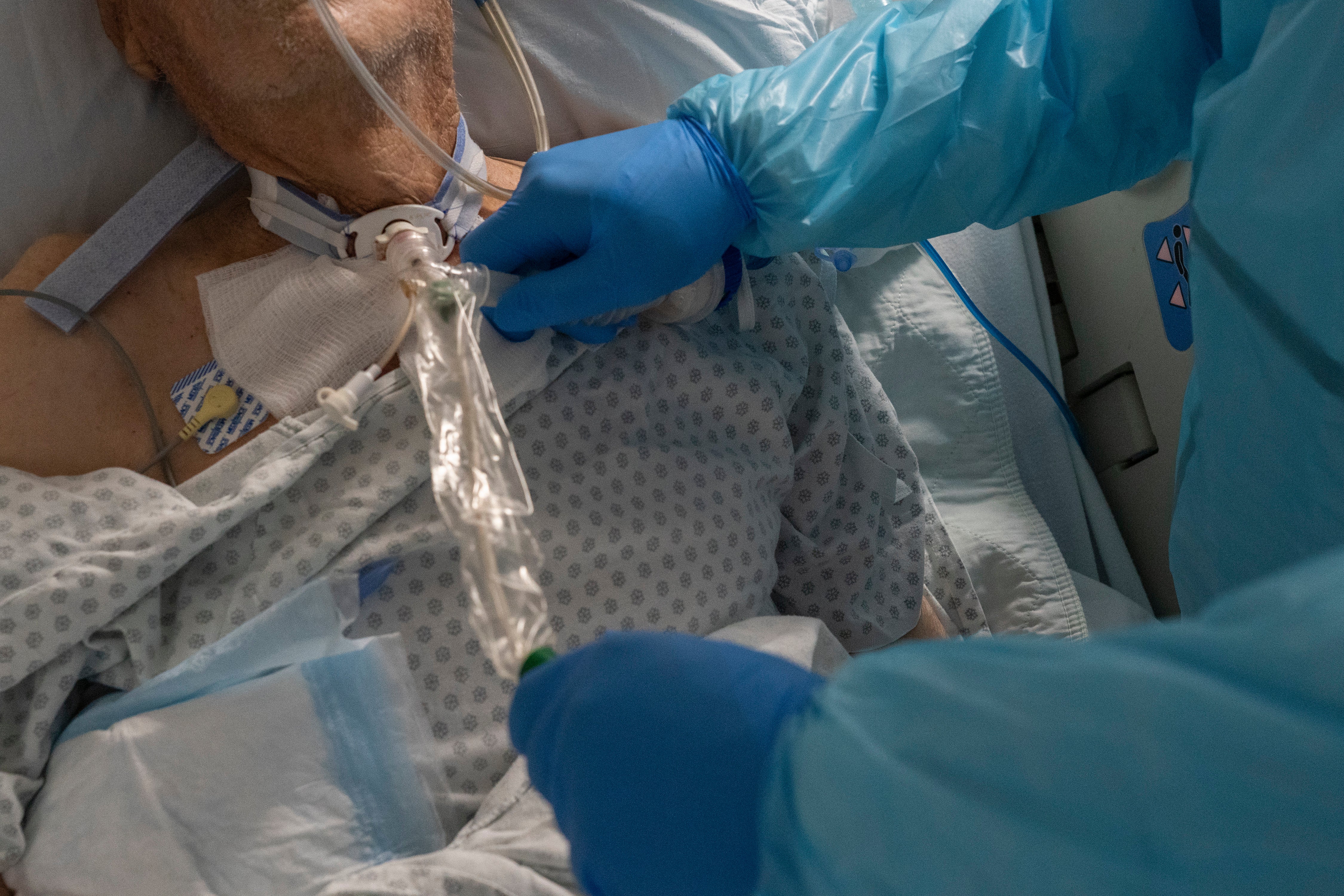 Life-threatening Fungal Infection That Can Live On Surfaces For Weeks Is Rising In The Us